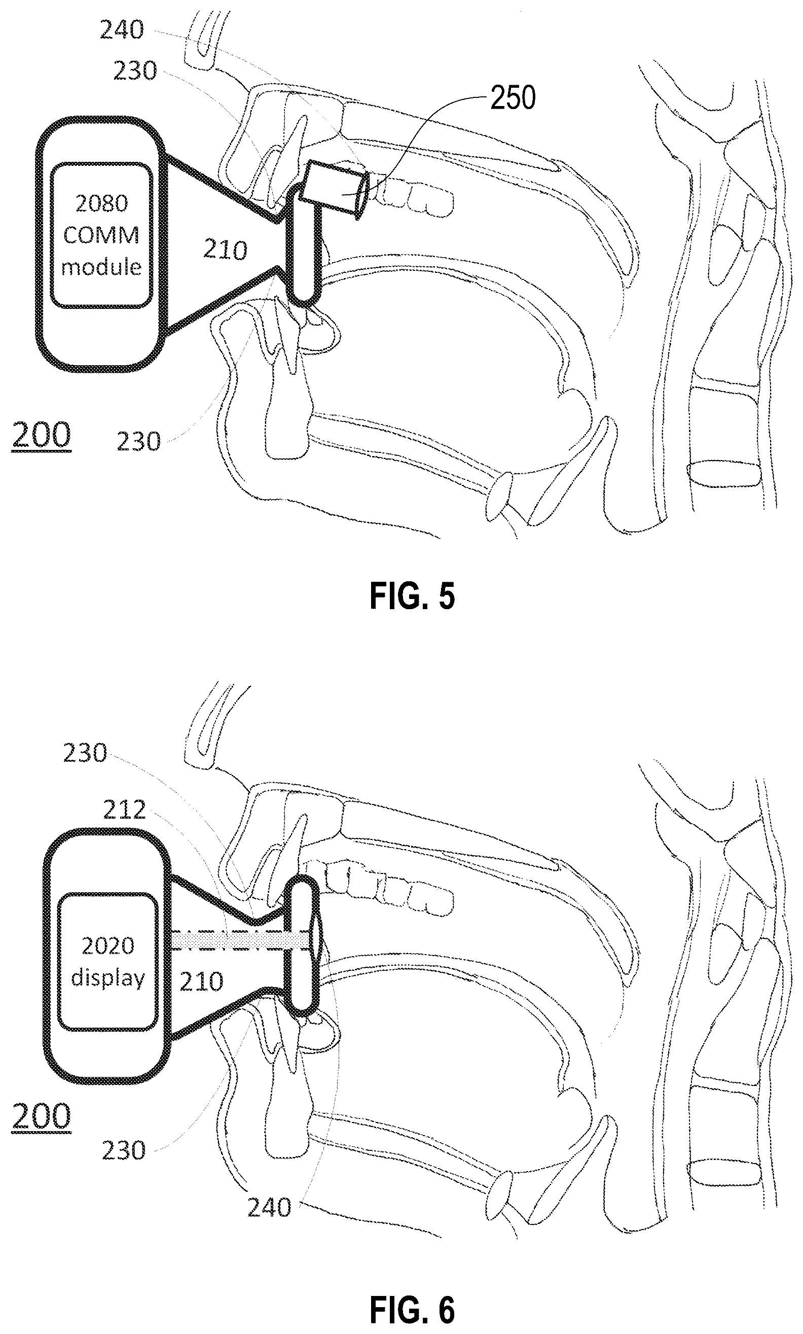 Patent US12137870 Figure 3 – Systems and methods for throat imaging