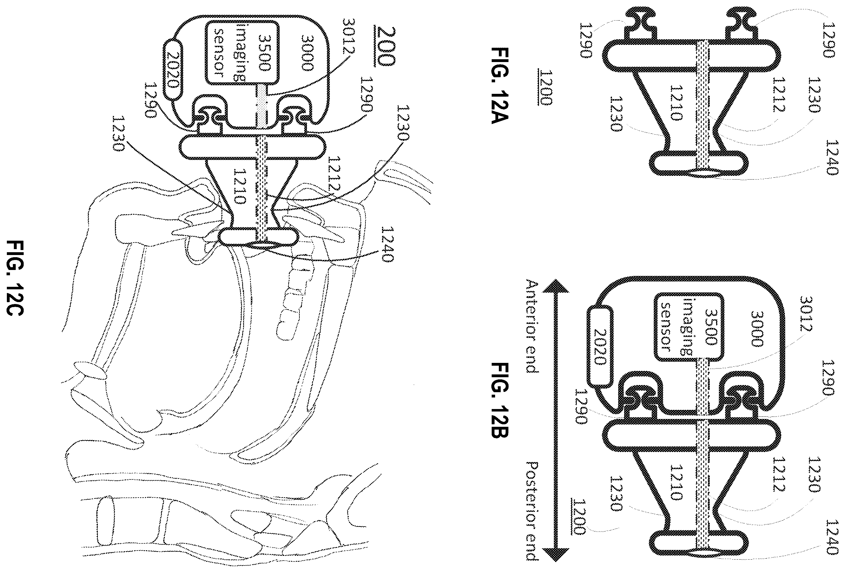 Patent US12137870 Figure 9 – Systems and methods for throat imaging