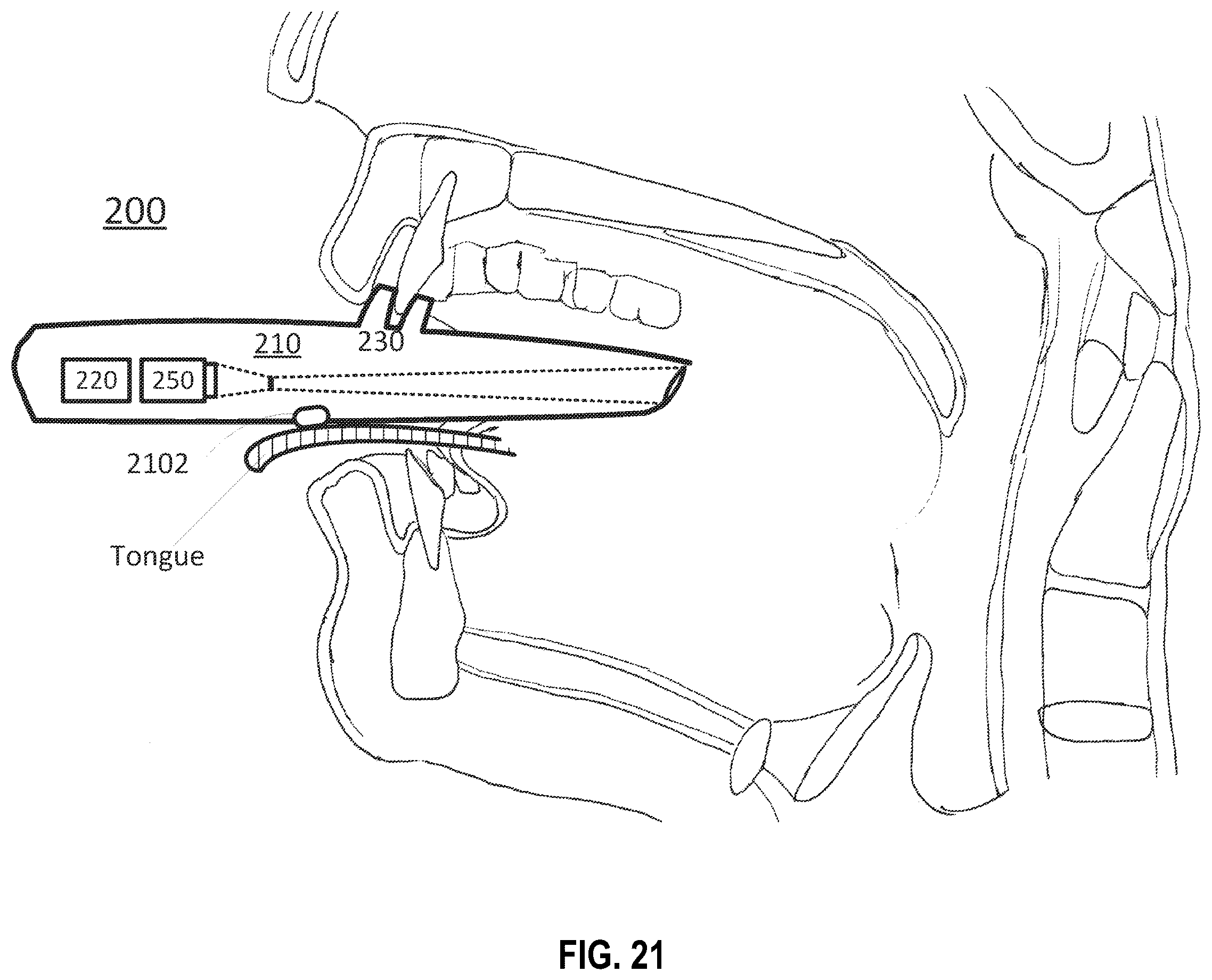 Patent US12137870 Figure 16 – Systems and methods for throat imaging