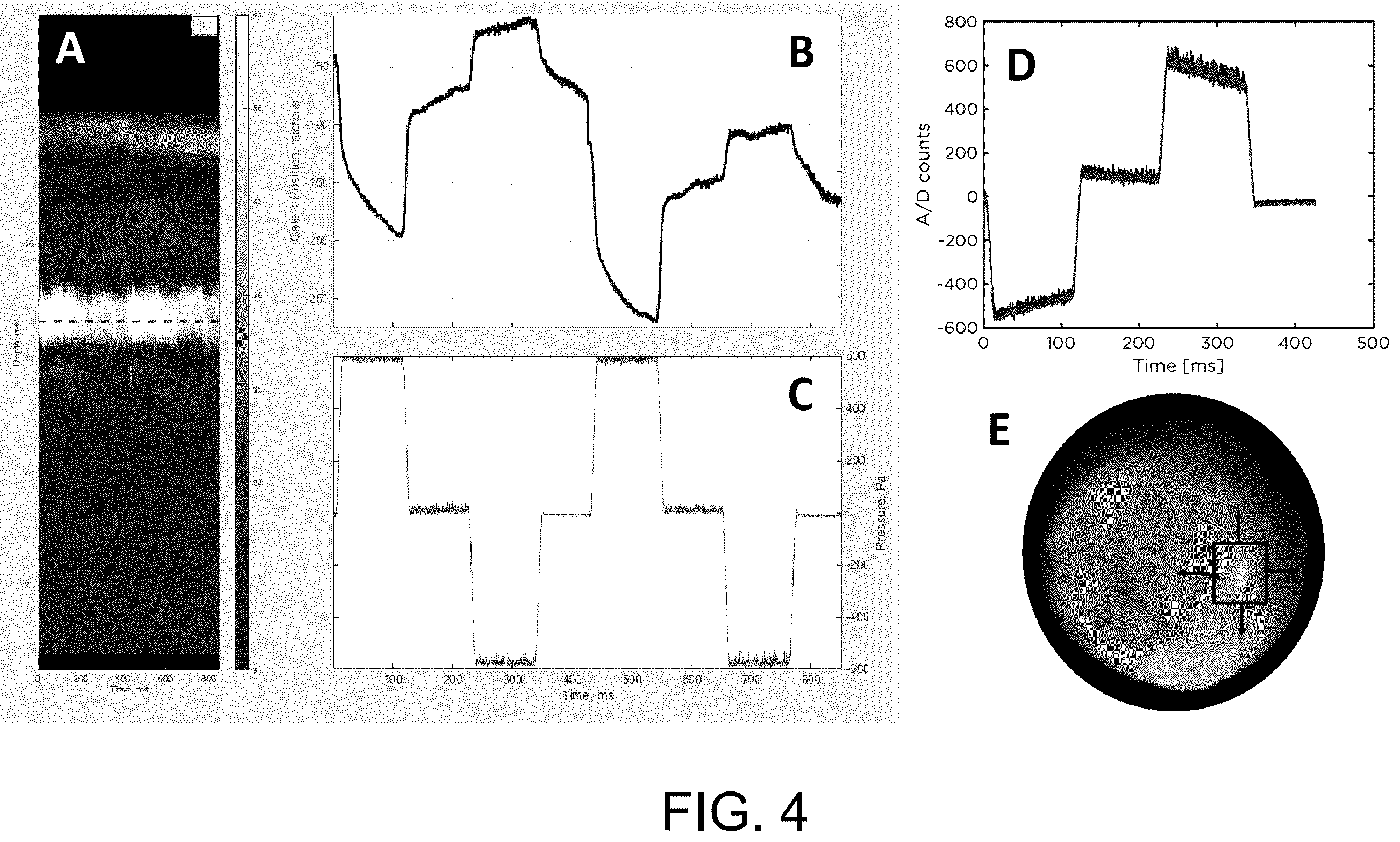 Patent US12137871 Figure 4 – Machine learning for otitis media diagnosis