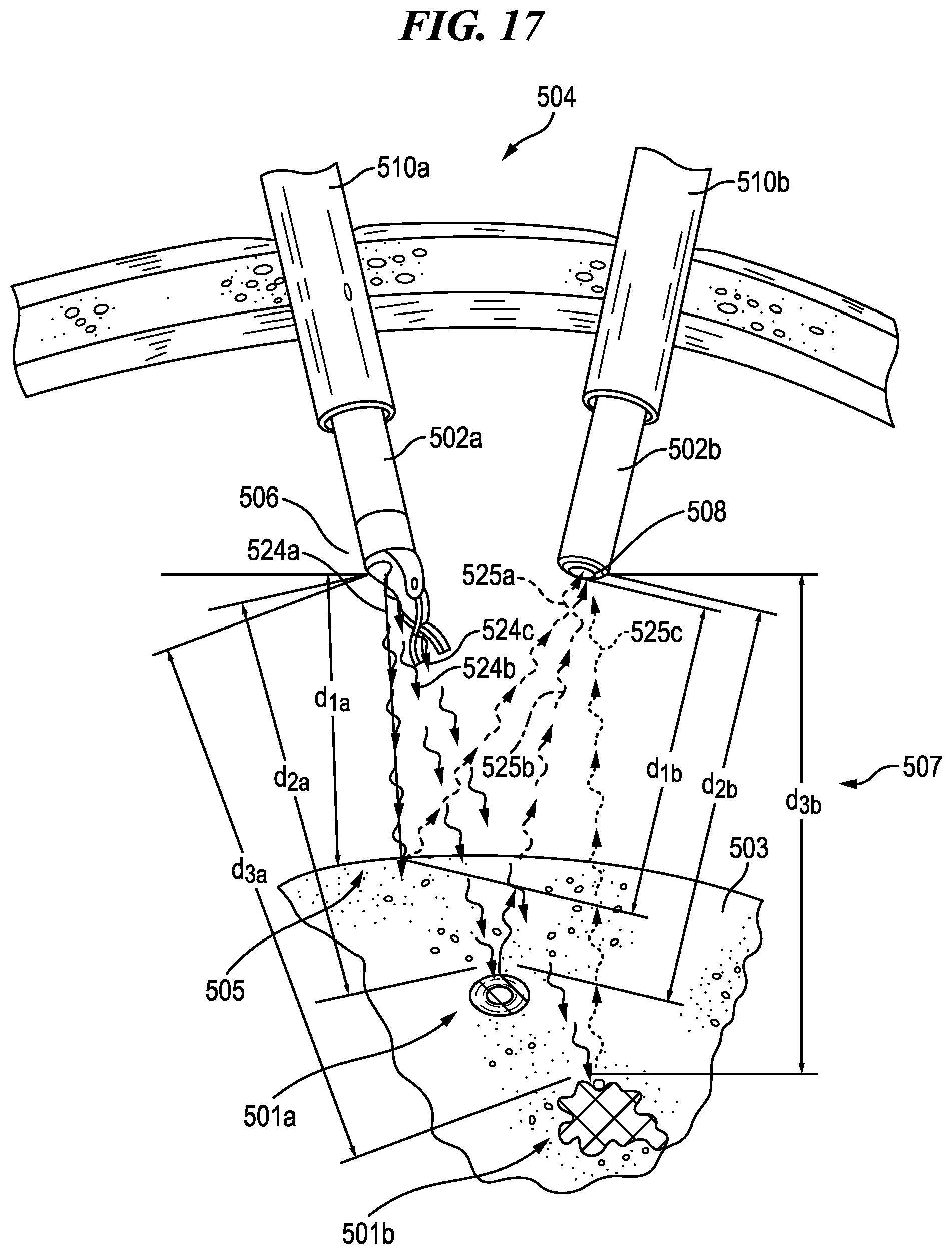 Patent US12137872 Figure 11 – Surgical devices, systems, and methods using multi-source imaging