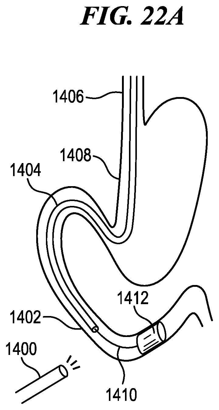 Patent US12137872 Figure 15 – Surgical devices, systems, and methods using multi-source imaging