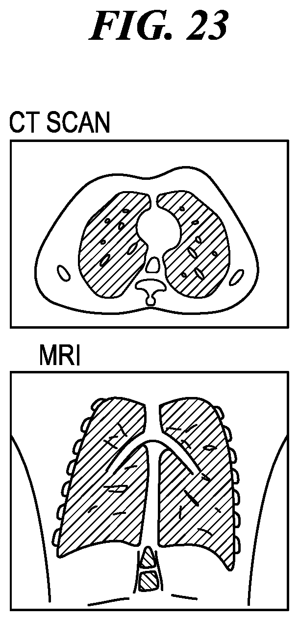 Patent US12137872 Figure 16 – Surgical devices, systems, and methods using multi-source imaging