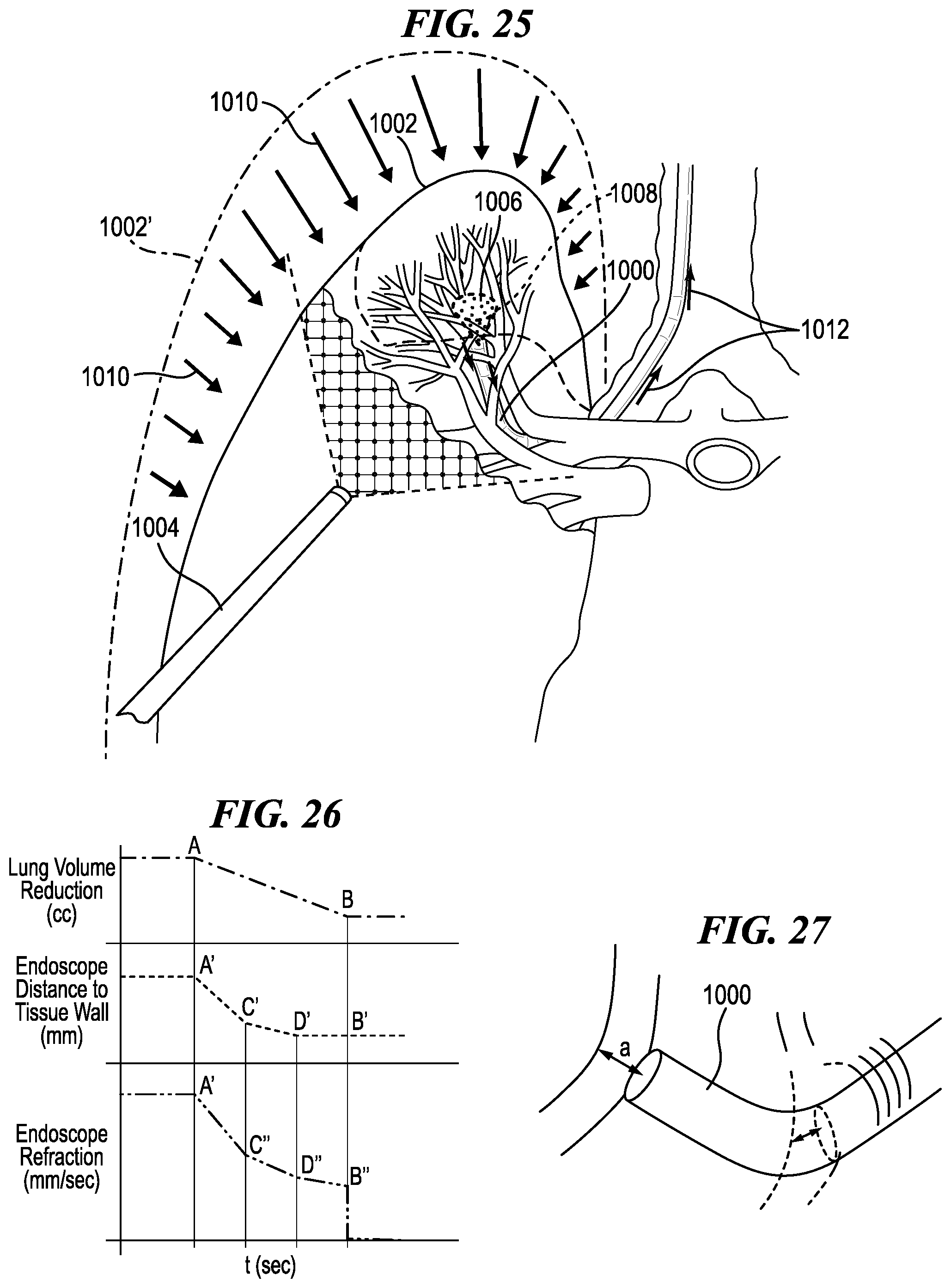 Patent US12137872 Figure 18 – Surgical devices, systems, and methods using multi-source imaging