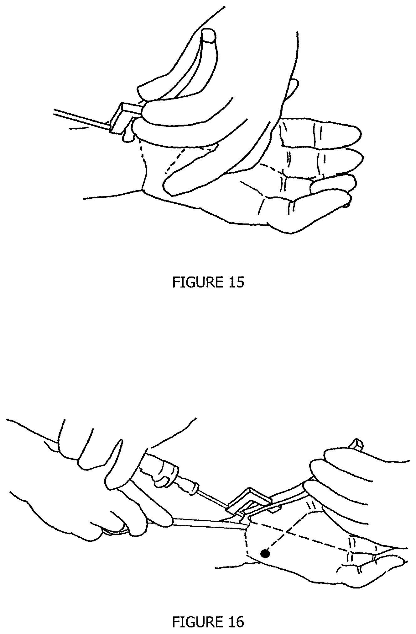 Patent US12137877 Figure 8 – Endoscopic-release surgical retractor