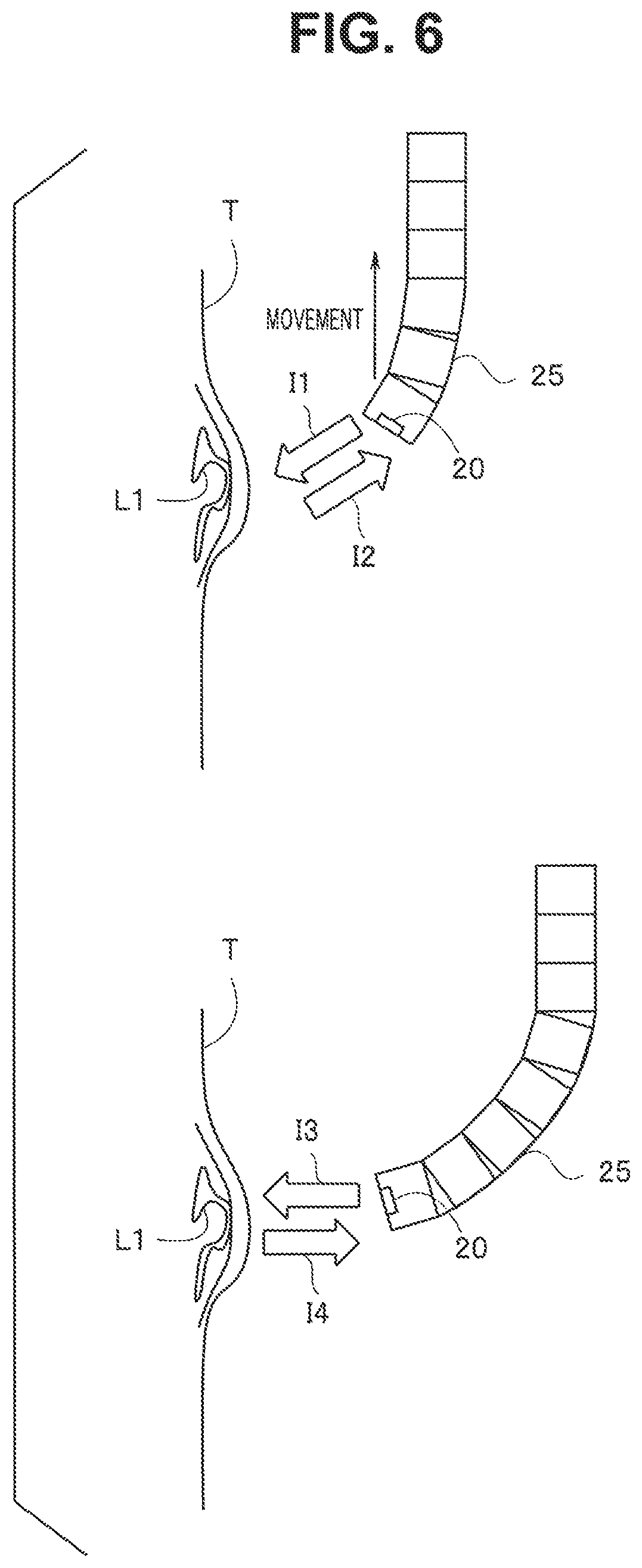 Patent US12137879 Figure 6 – Image processing apparatus, image processing method, and endoscope apparatus