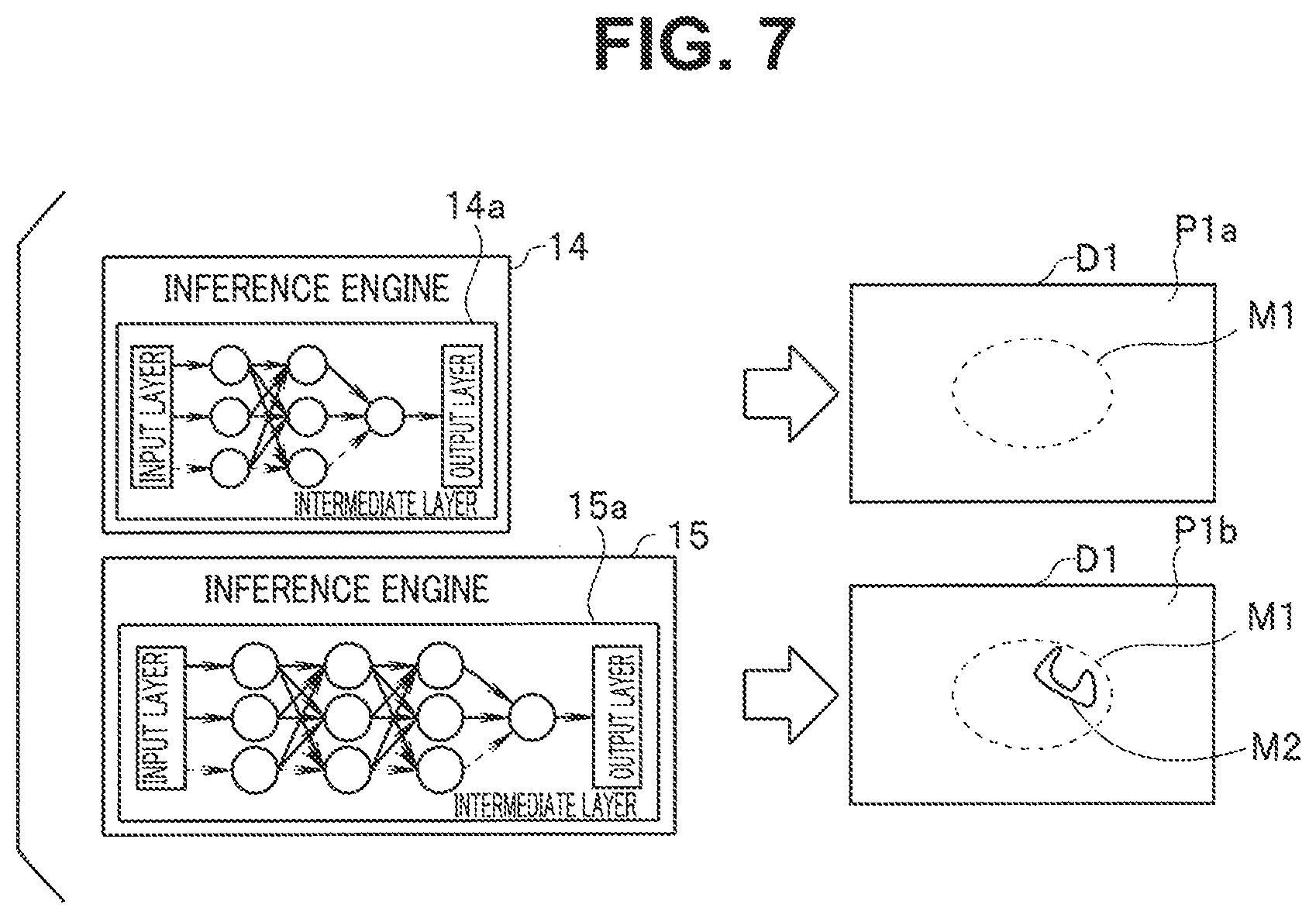 Patent US12137879 Figure 7 – Image processing apparatus, image processing method, and endoscope apparatus