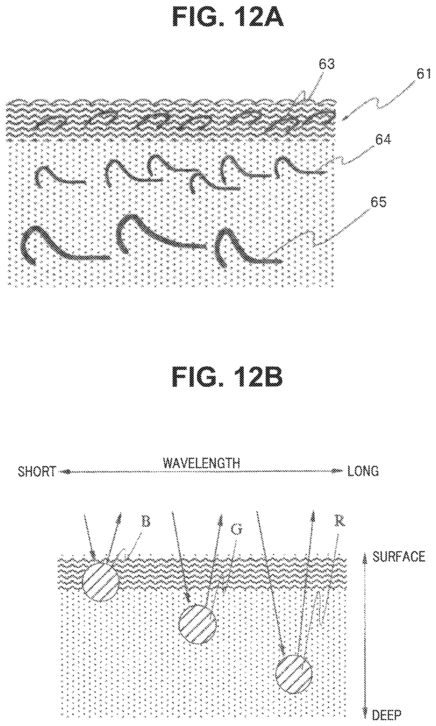 Patent US12137879 Figure 12 – Image processing apparatus, image processing method, and endoscope apparatus