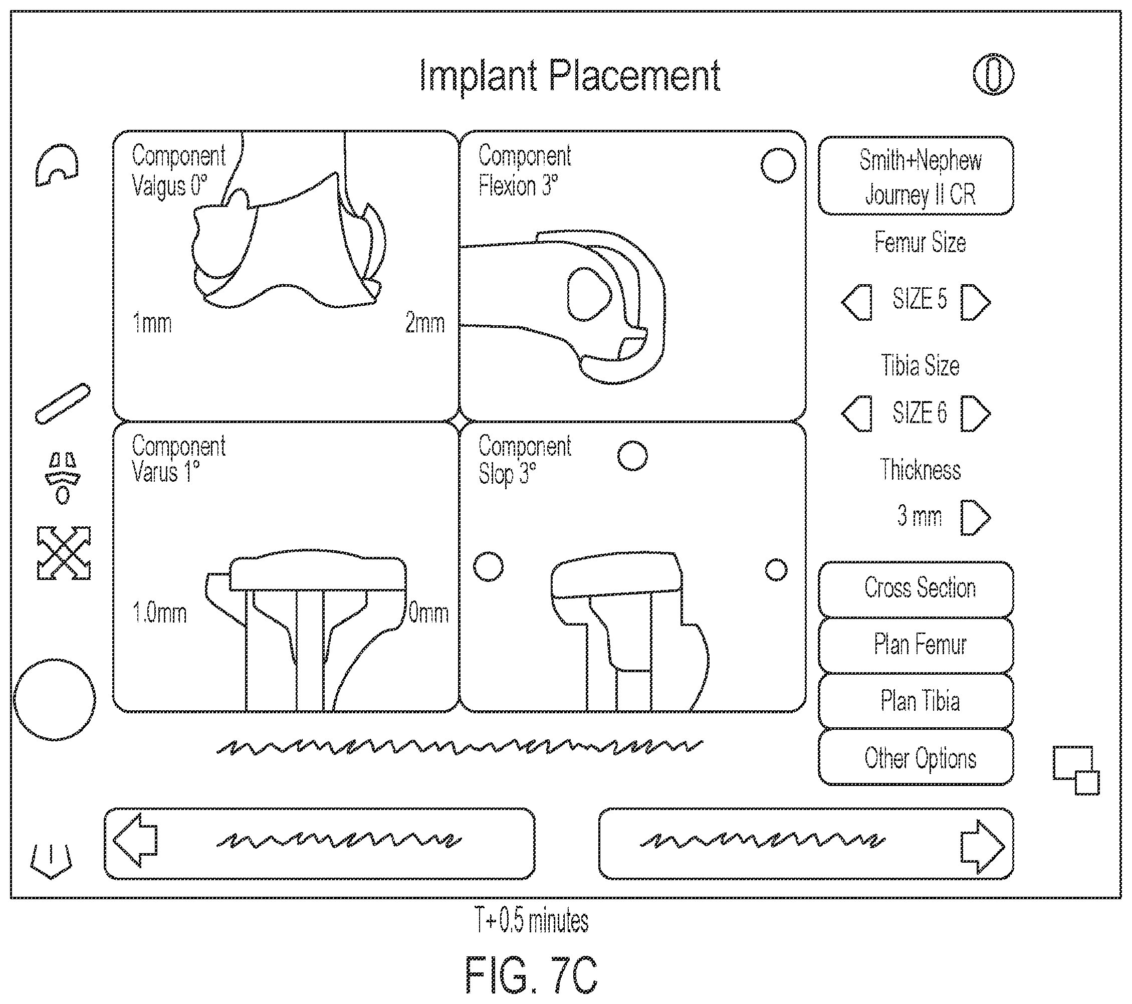 Patent US12137883 Figure 11 – User interface for digital markers in arthroscopy