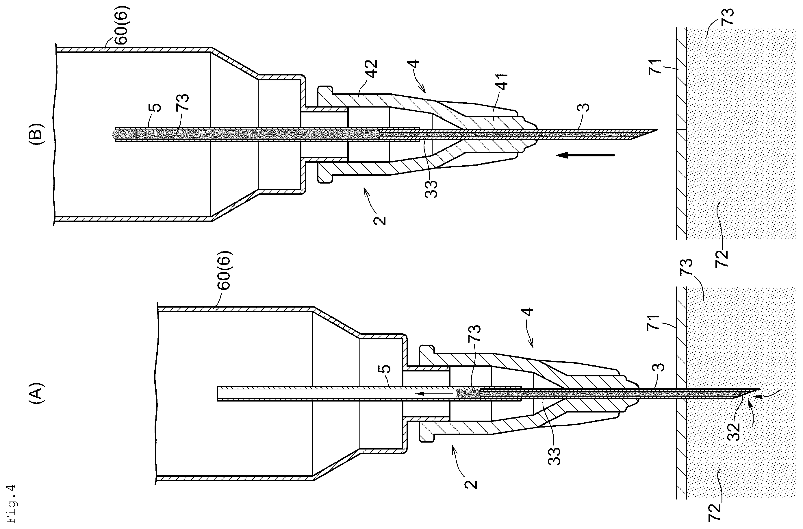 Patent US12137885 Figure 4 – Bodily fluid collection device