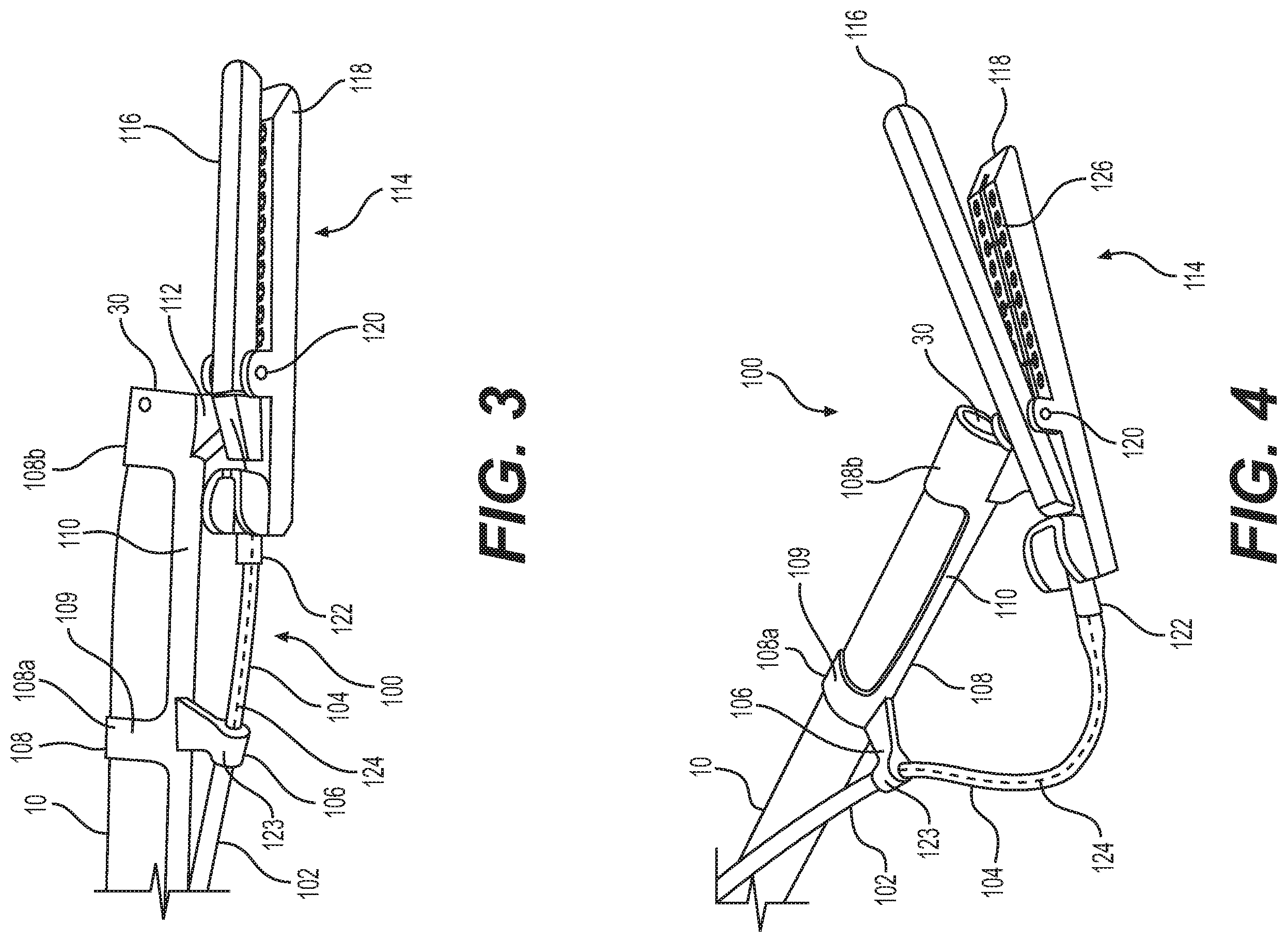Patent US12137888 Figure 3 – Fastening device and related methods of use