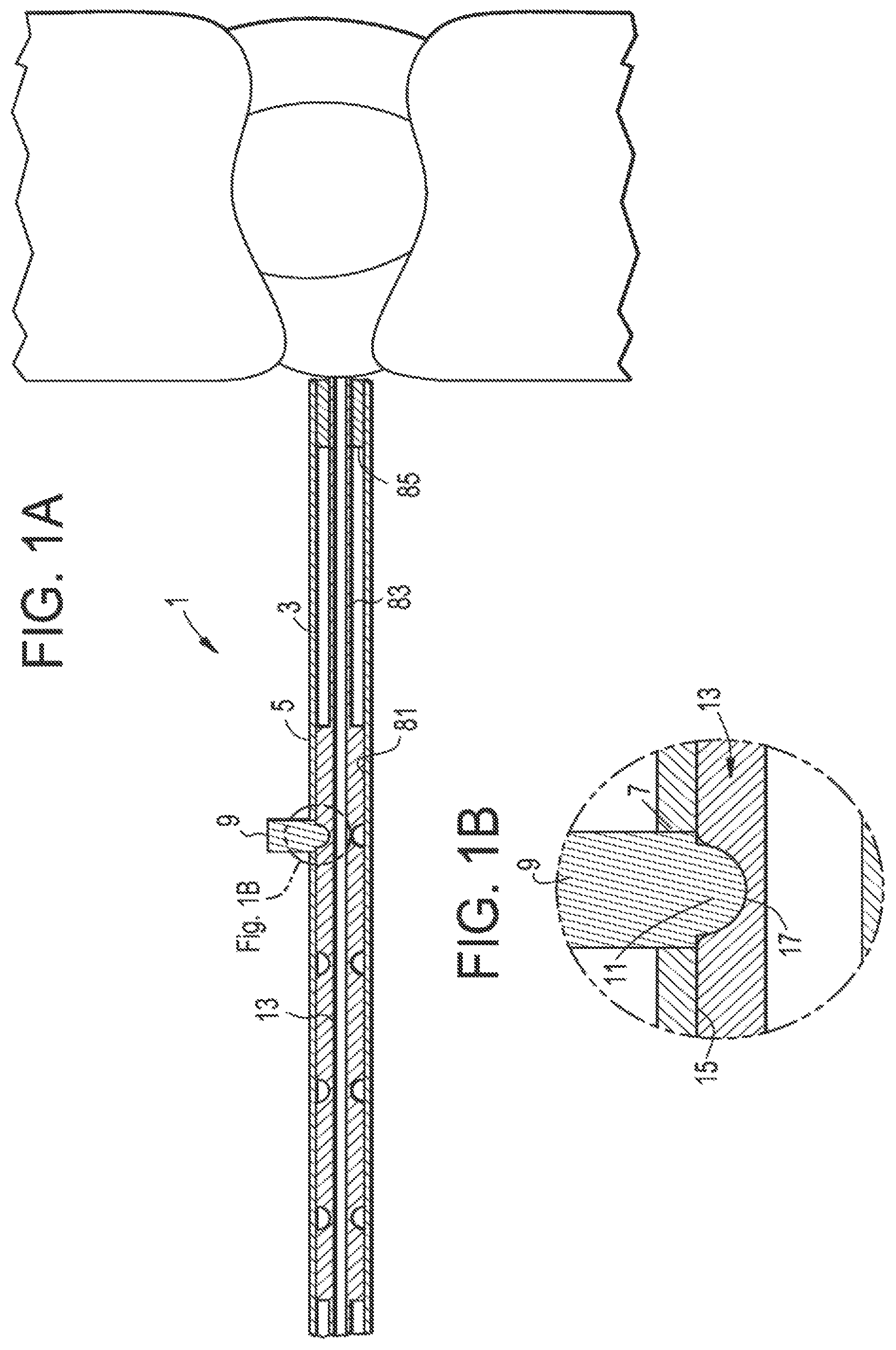 Patent US12137891 Figure 1 – Intervertebral disc puncture and treatment system