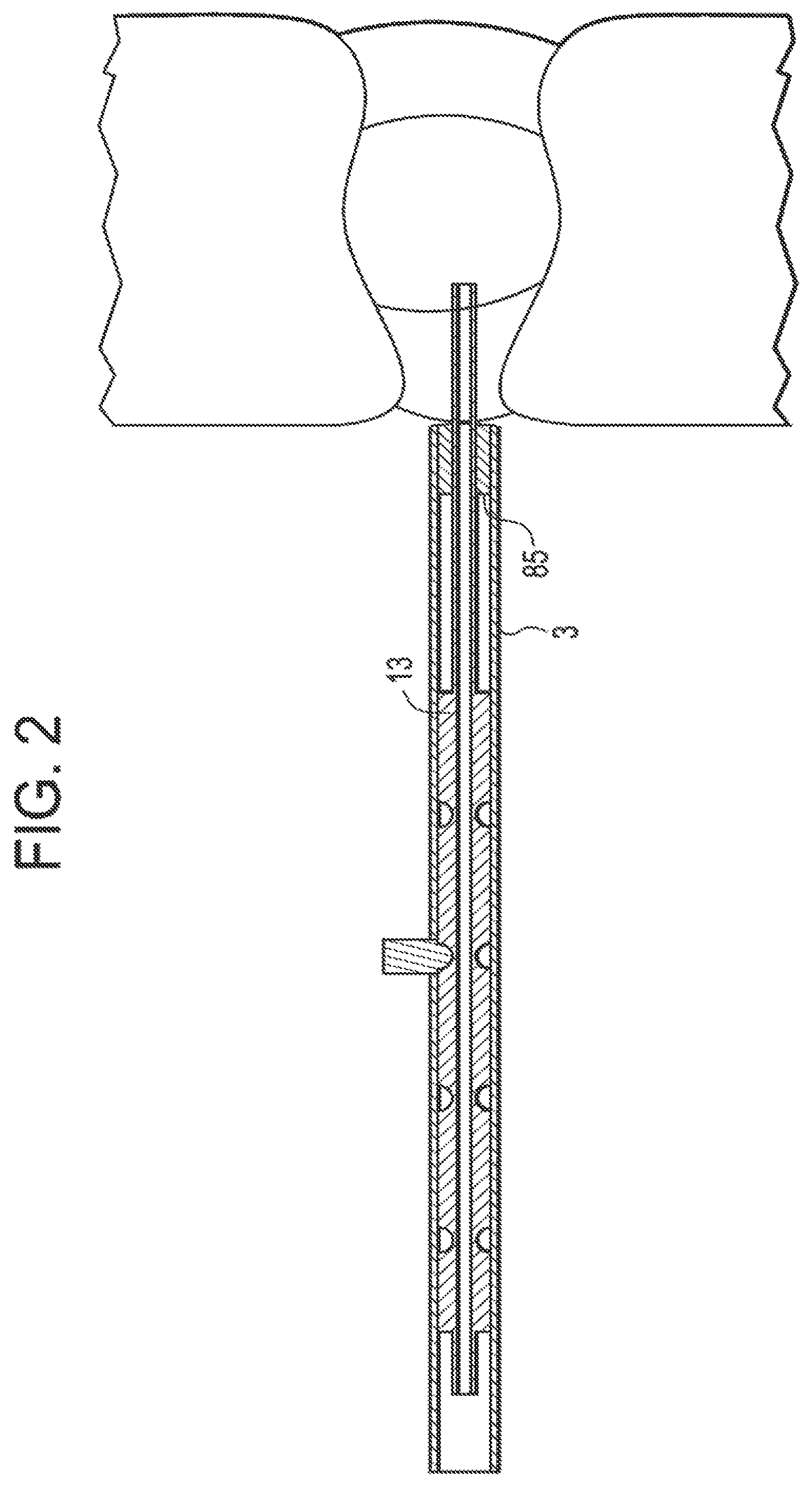 Patent US12137891 Figure 2 – Intervertebral disc puncture and treatment system