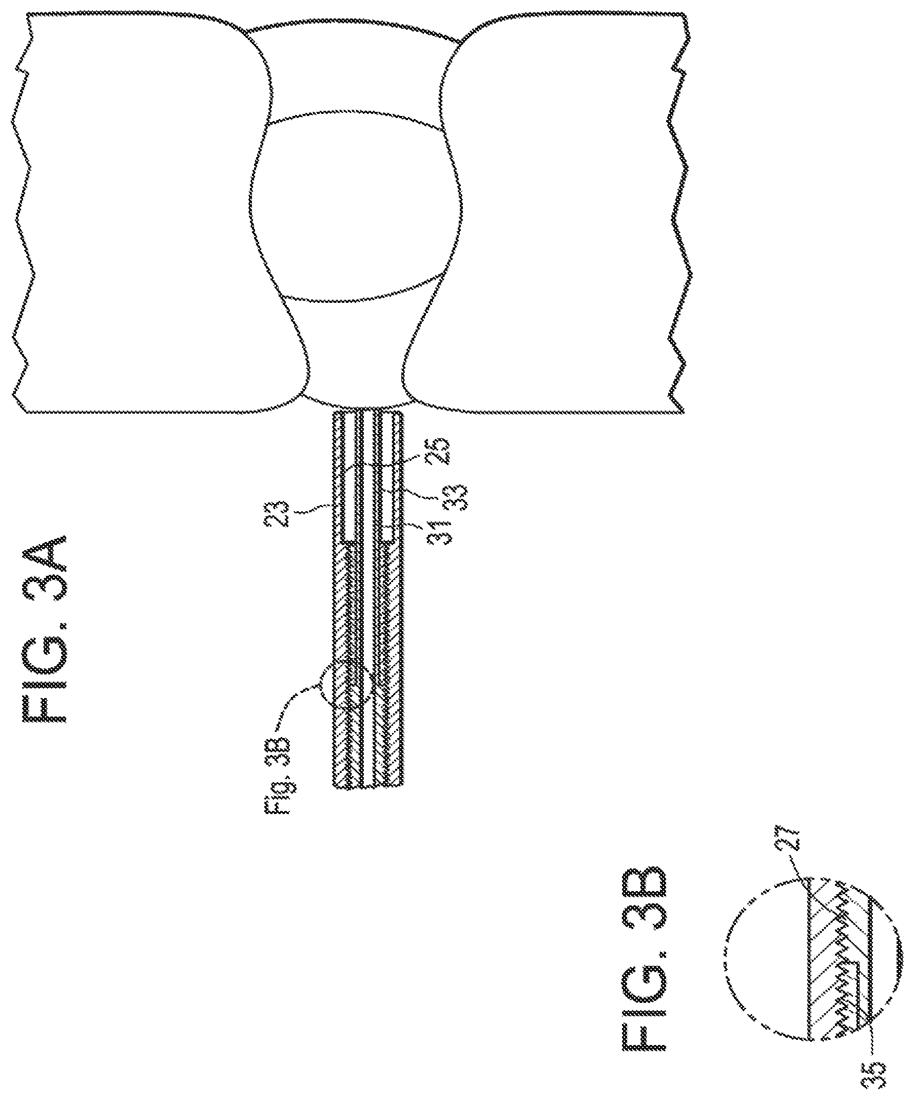Patent US12137891 Figure 3 – Intervertebral disc puncture and treatment system
