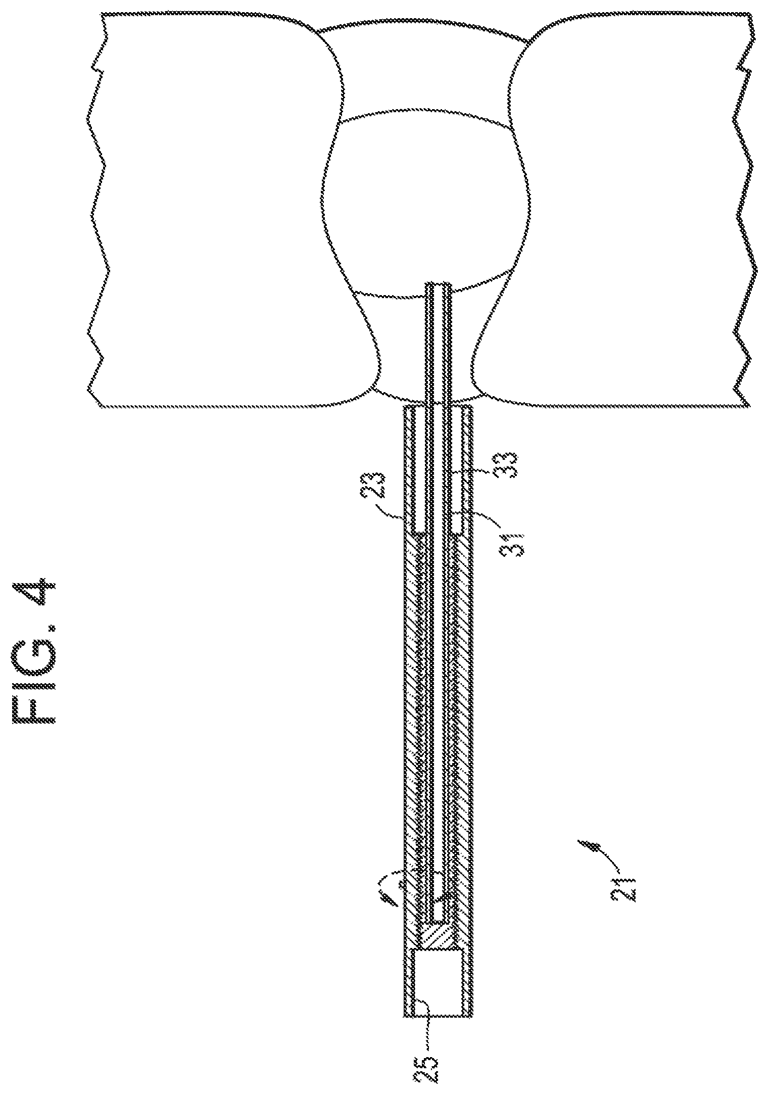 Patent US12137891 Figure 4 – Intervertebral disc puncture and treatment system