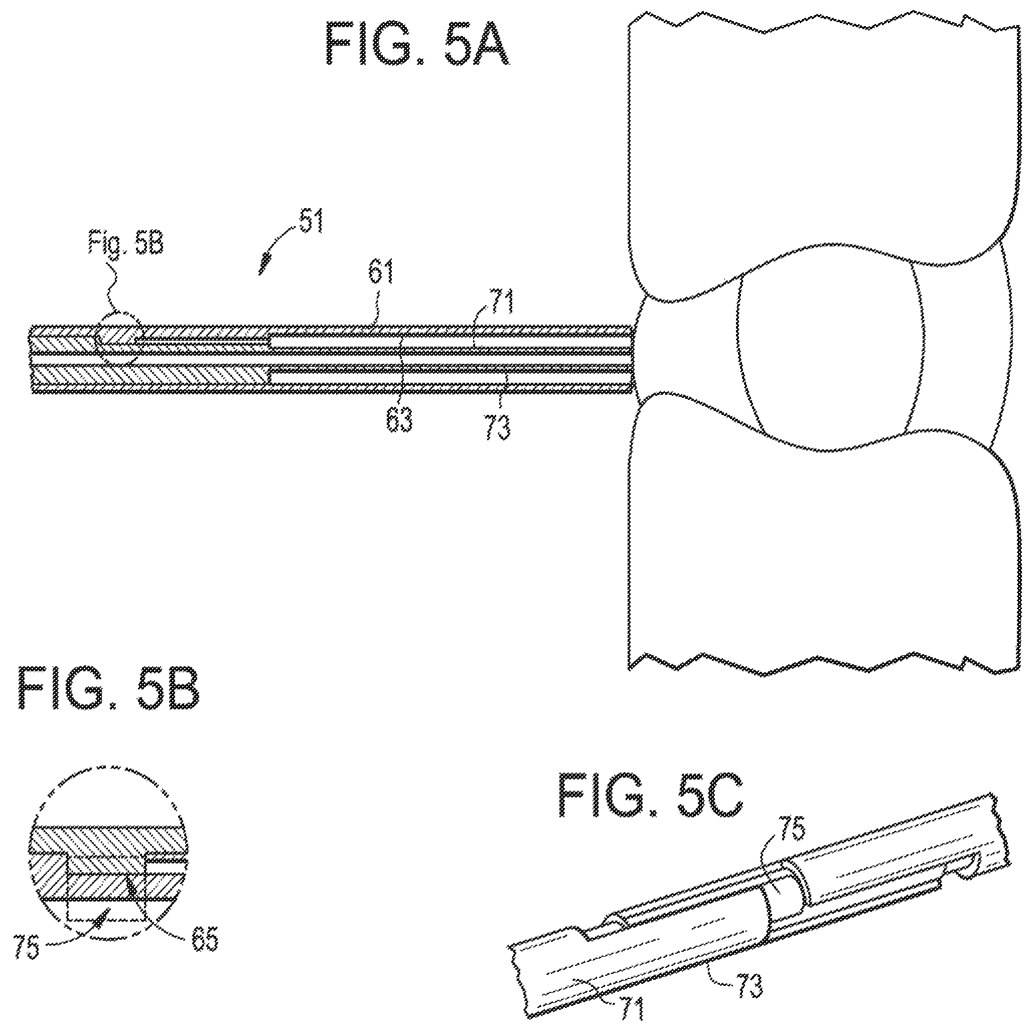Patent US12137891 Figure 5 – Intervertebral disc puncture and treatment system