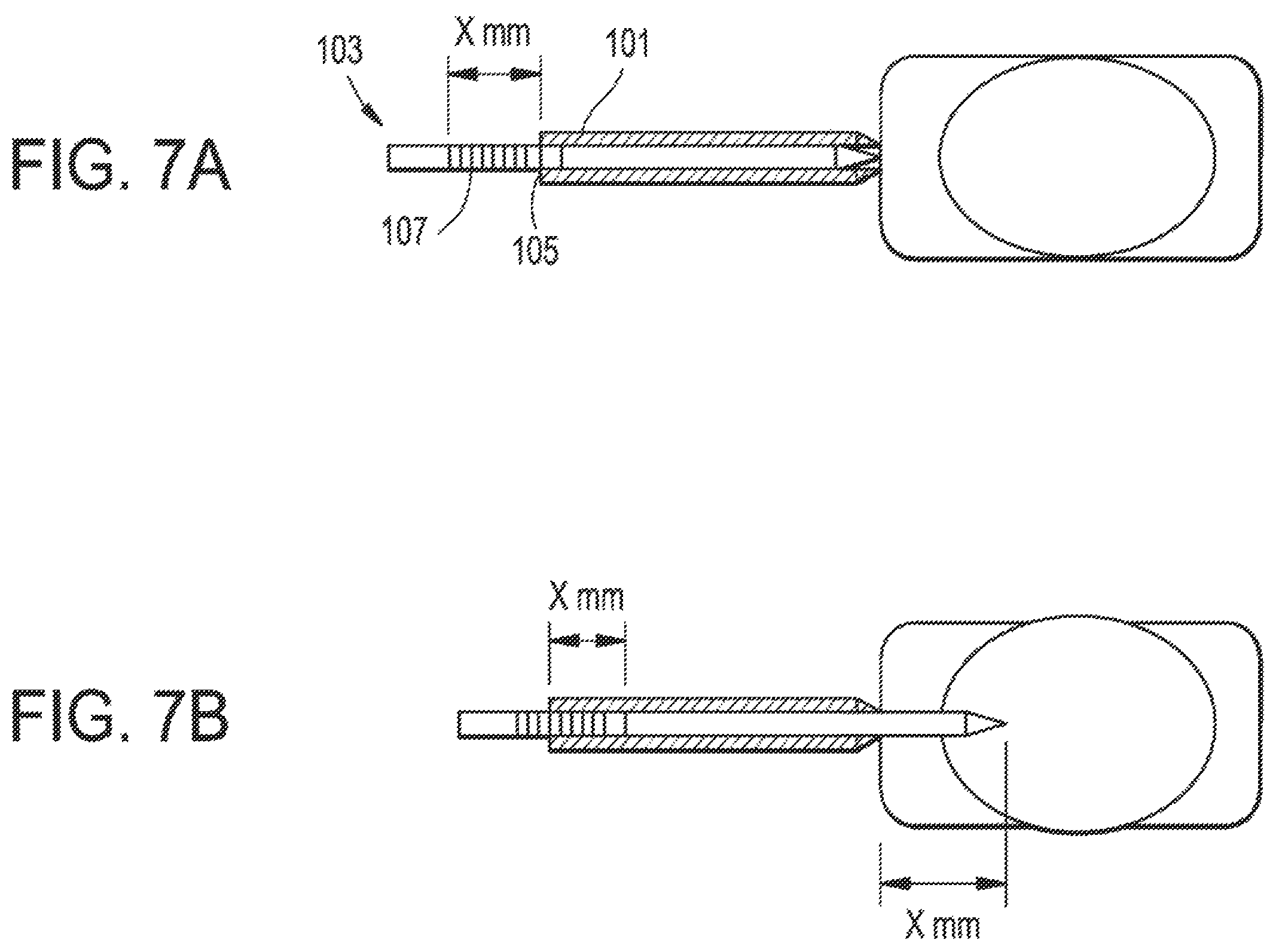 Patent US12137891 Figure 7 – Intervertebral disc puncture and treatment system