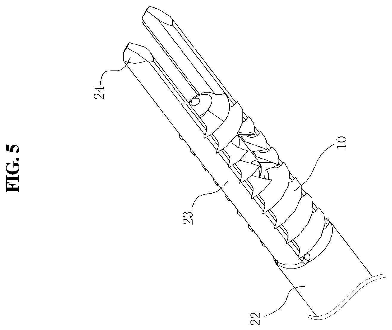 Patent US12137893 Figure 5 – Perforator-integral suture anchor device
