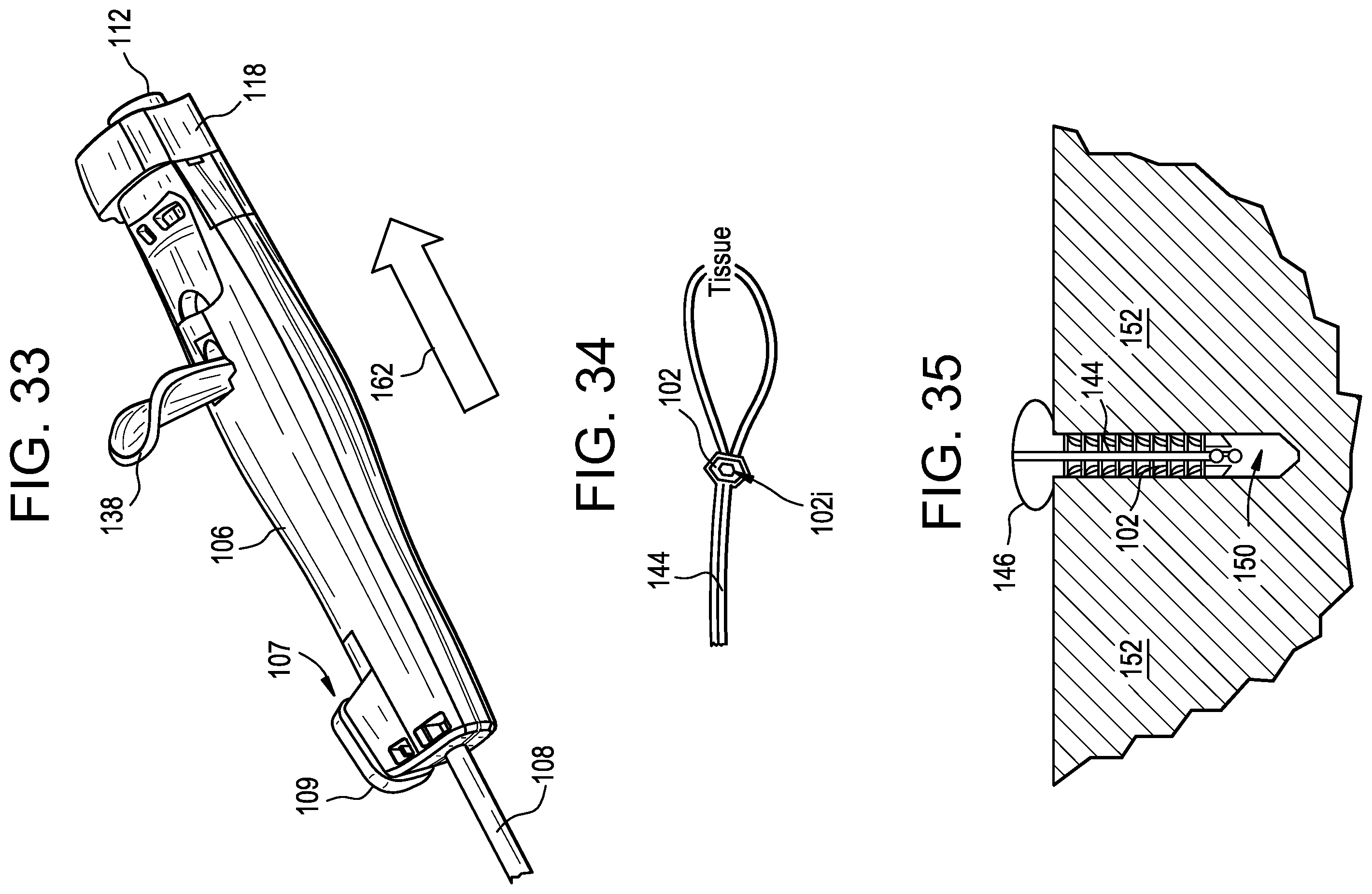 Patent US12137894 Figure 17 – Knotless anchor inserter tool extraction