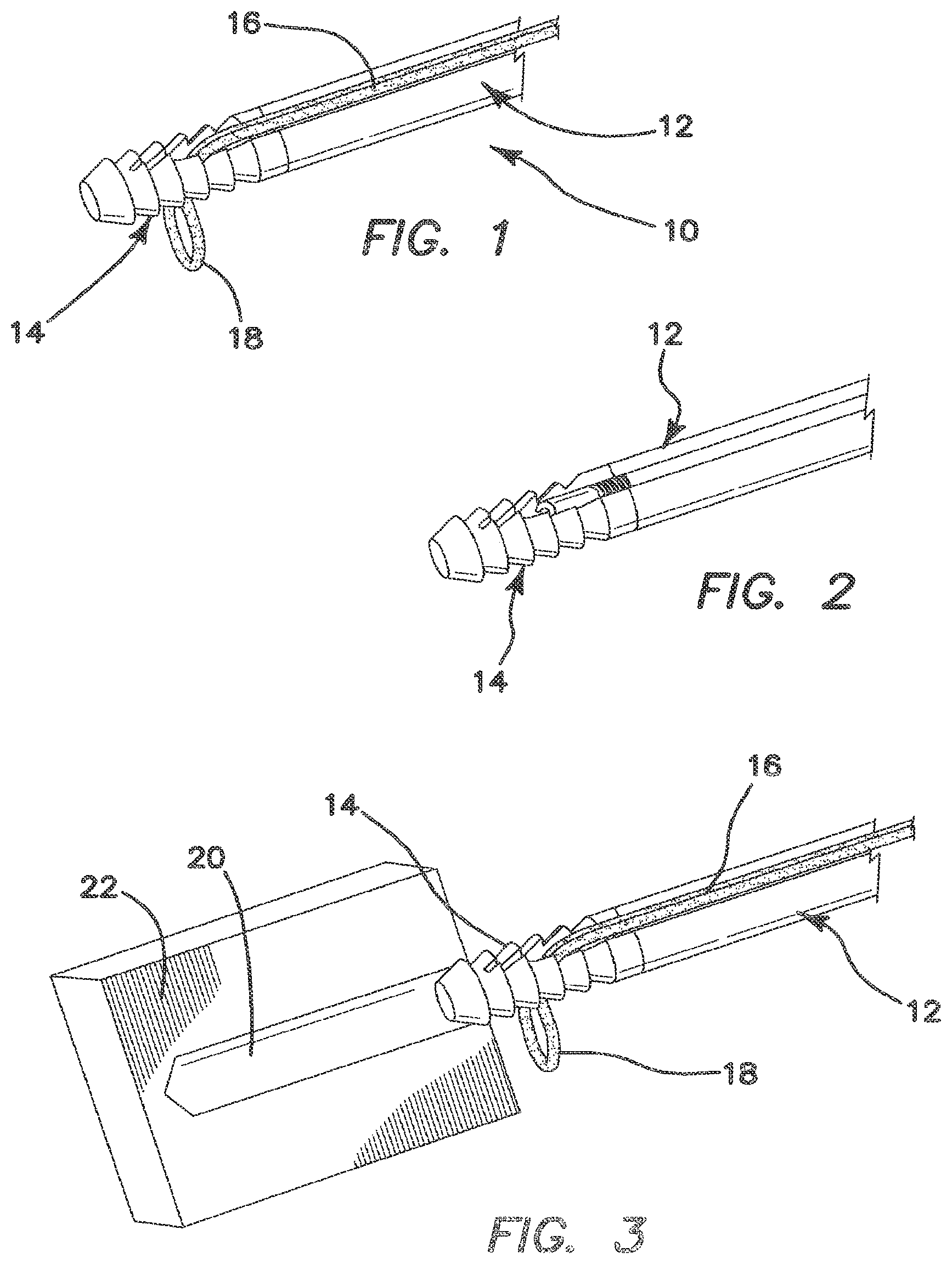 Patent US12137895 Figure 1 – Anchors and methods for securing suture to bone
