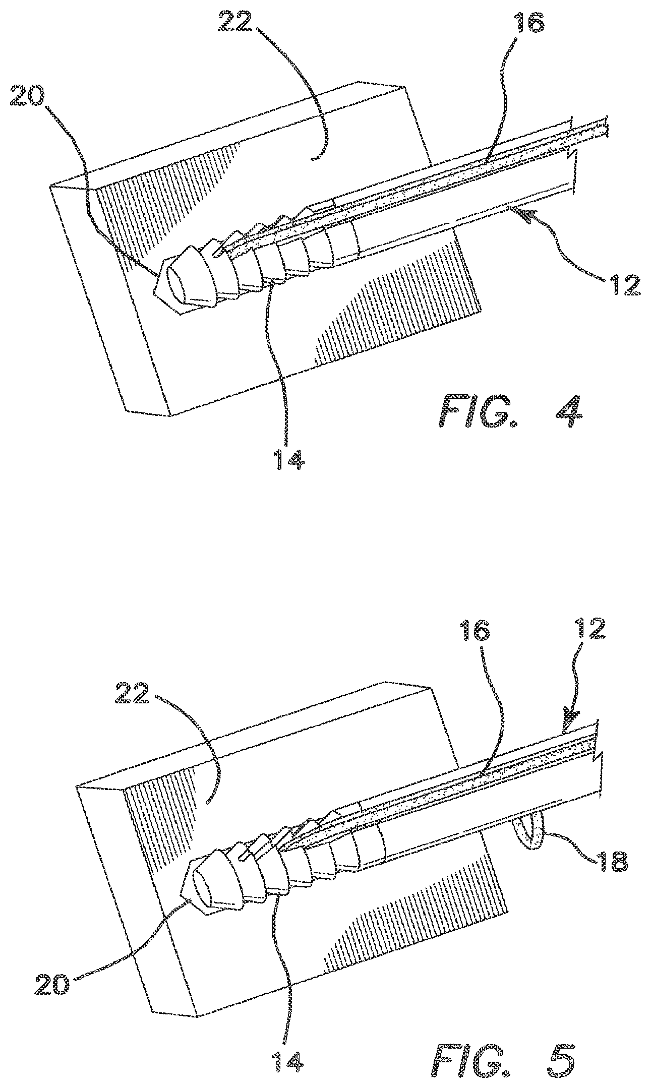 Patent US12137895 Figure 2 – Anchors and methods for securing suture to bone