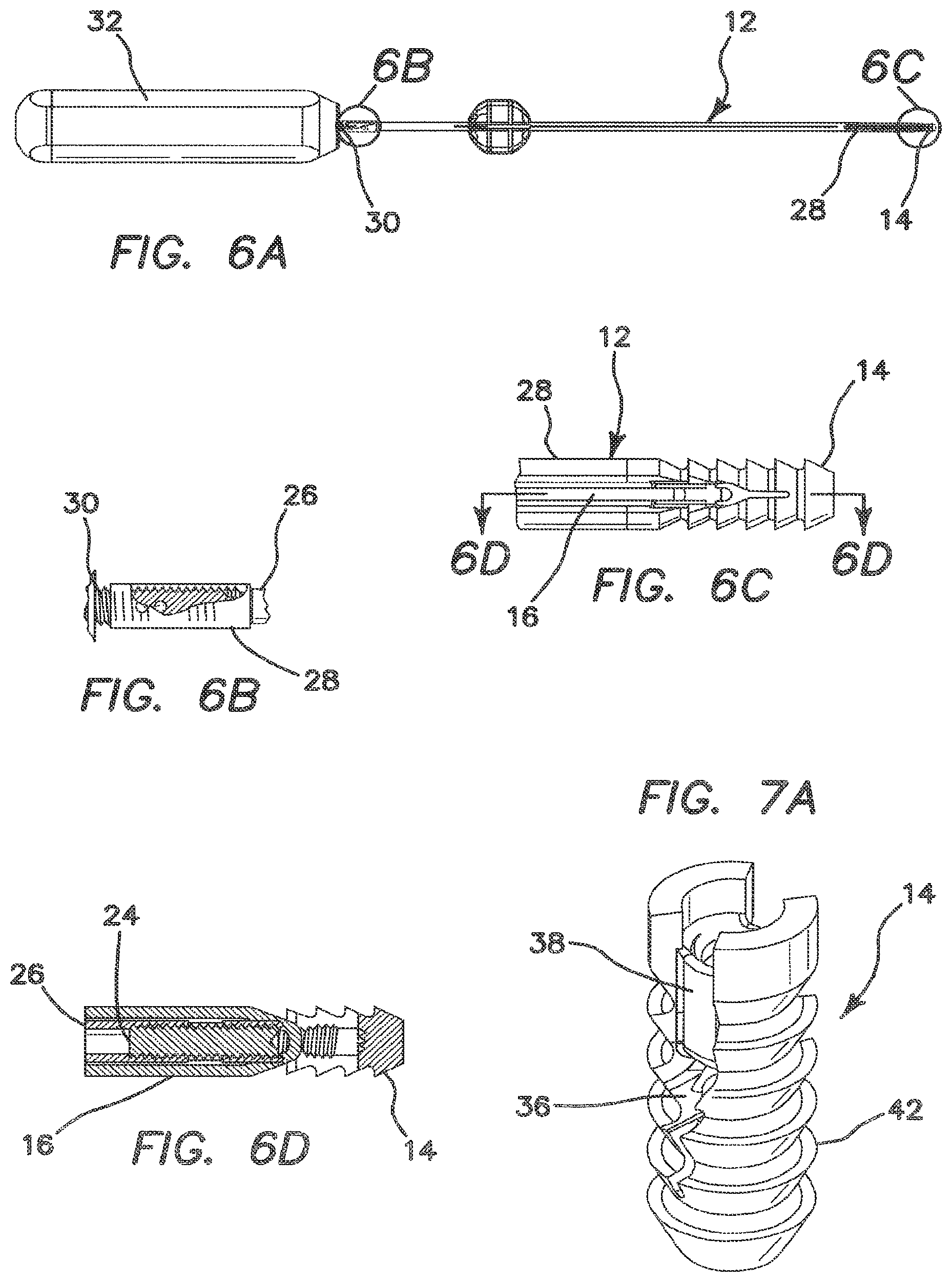 Patent US12137895 Figure 3 – Anchors and methods for securing suture to bone