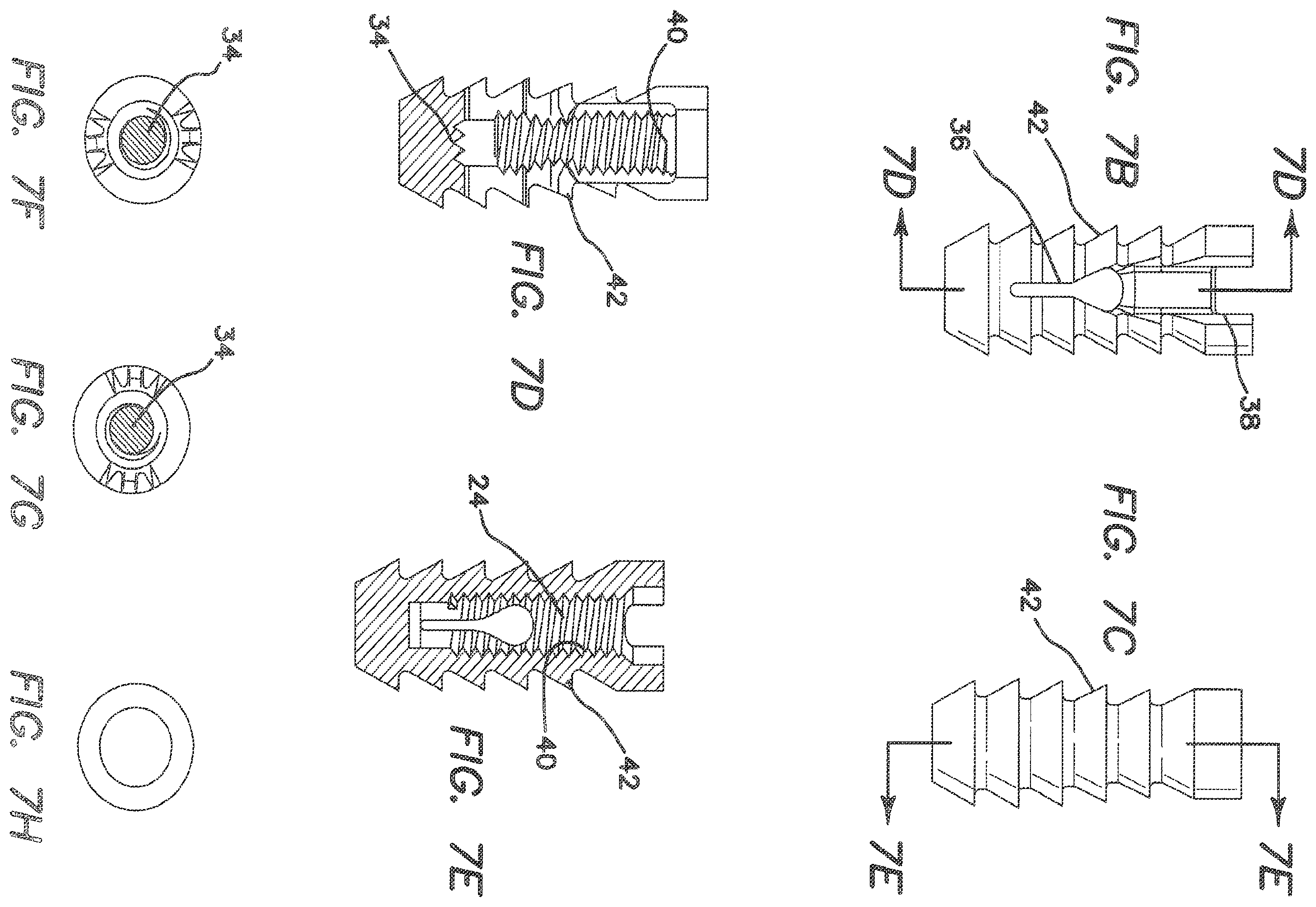 Patent US12137895 Figure 4 – Anchors and methods for securing suture to bone