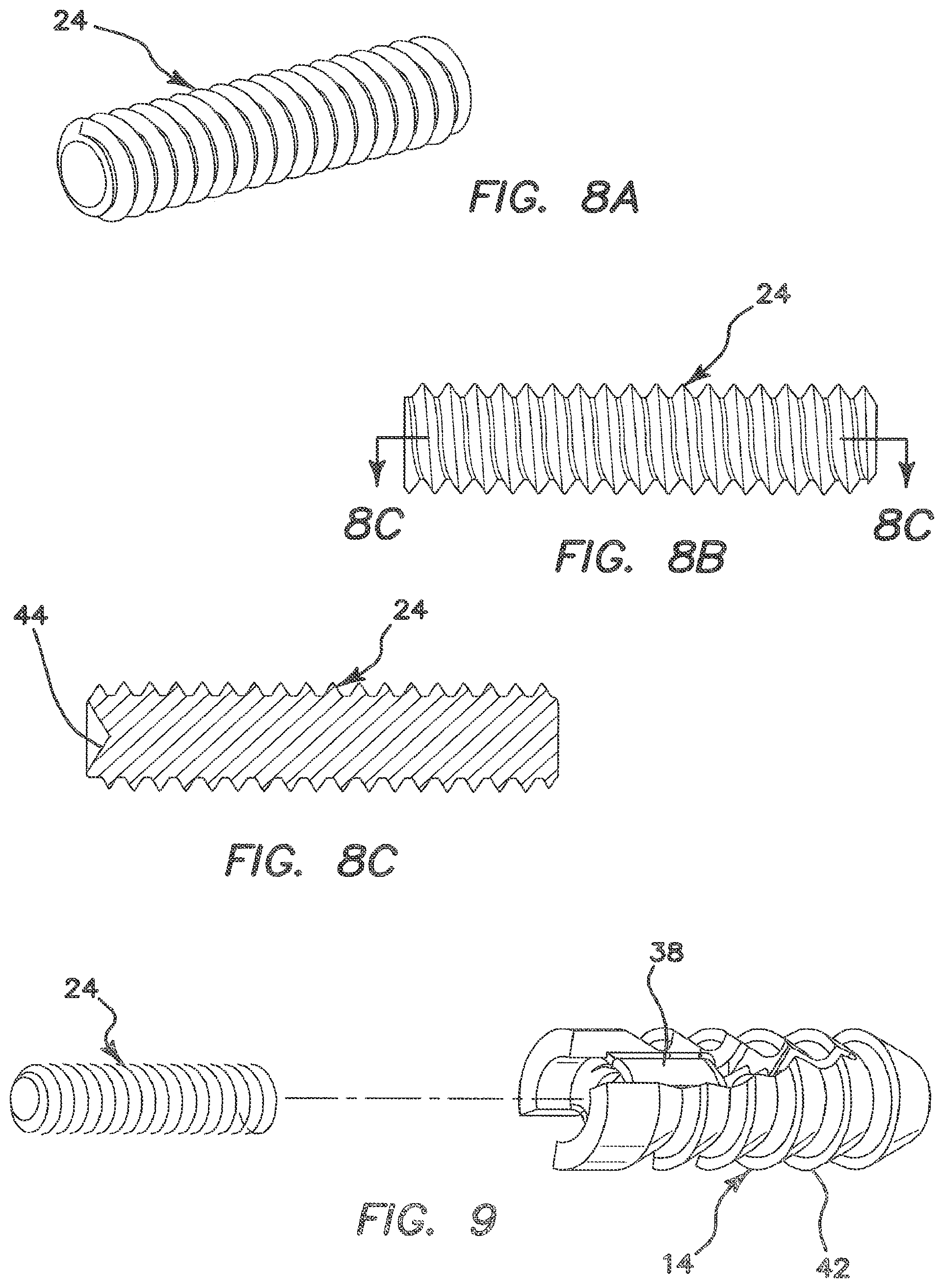 Patent US12137895 Figure 5 – Anchors and methods for securing suture to bone