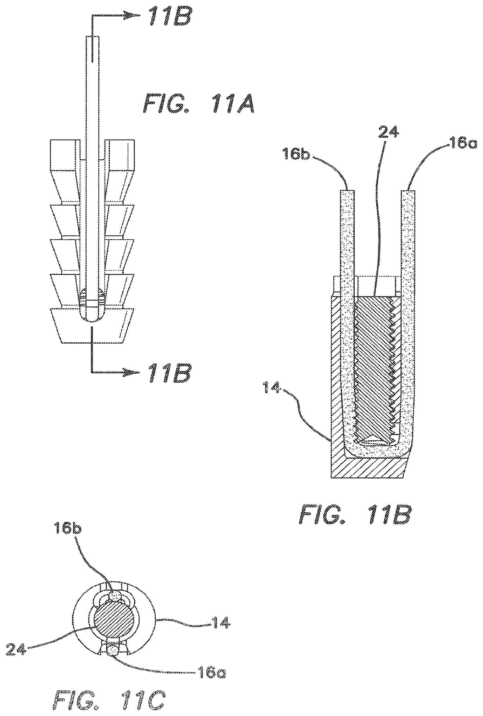 Patent US12137895 Figure 7 – Anchors and methods for securing suture to bone