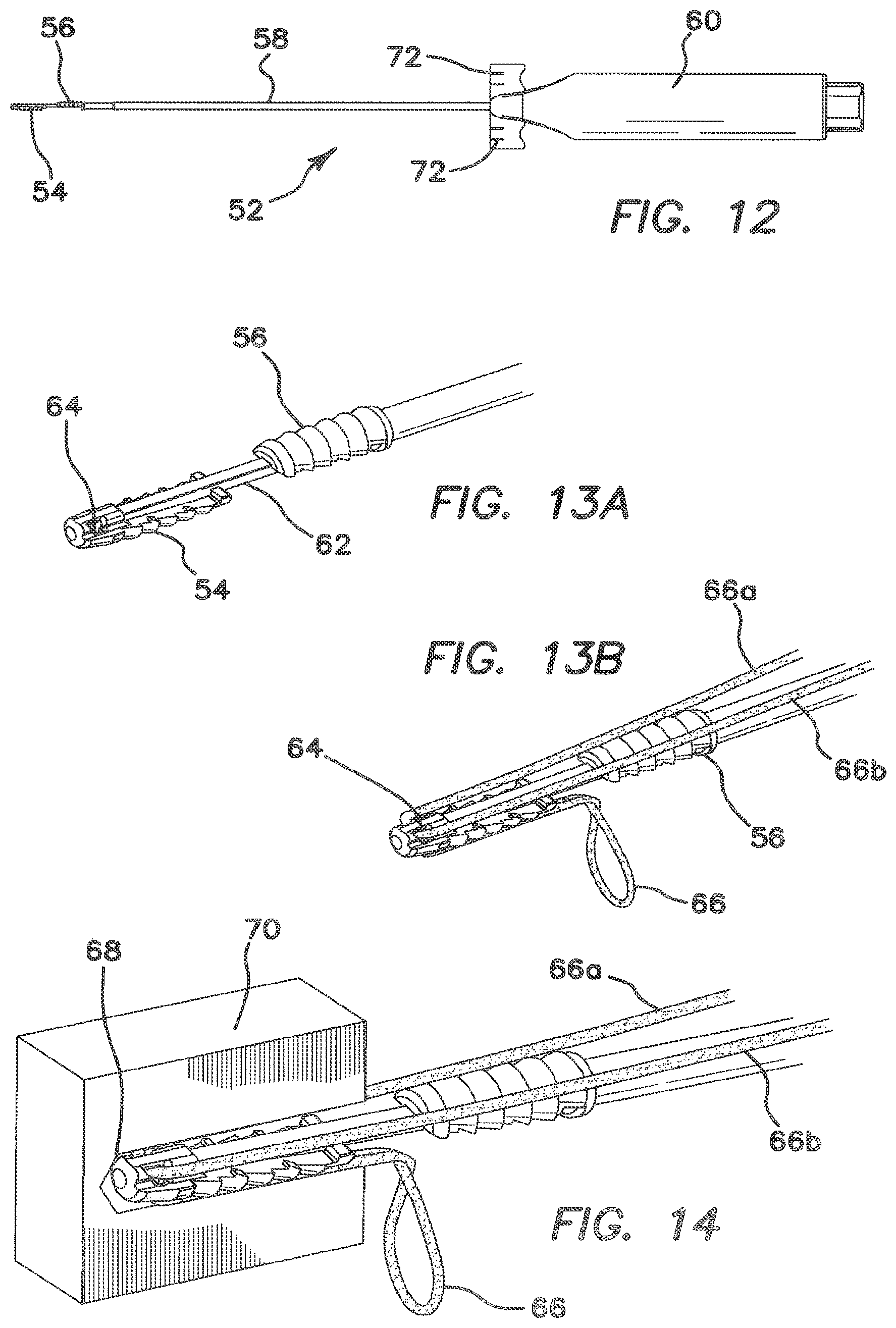 Patent US12137895 Figure 8 – Anchors and methods for securing suture to bone