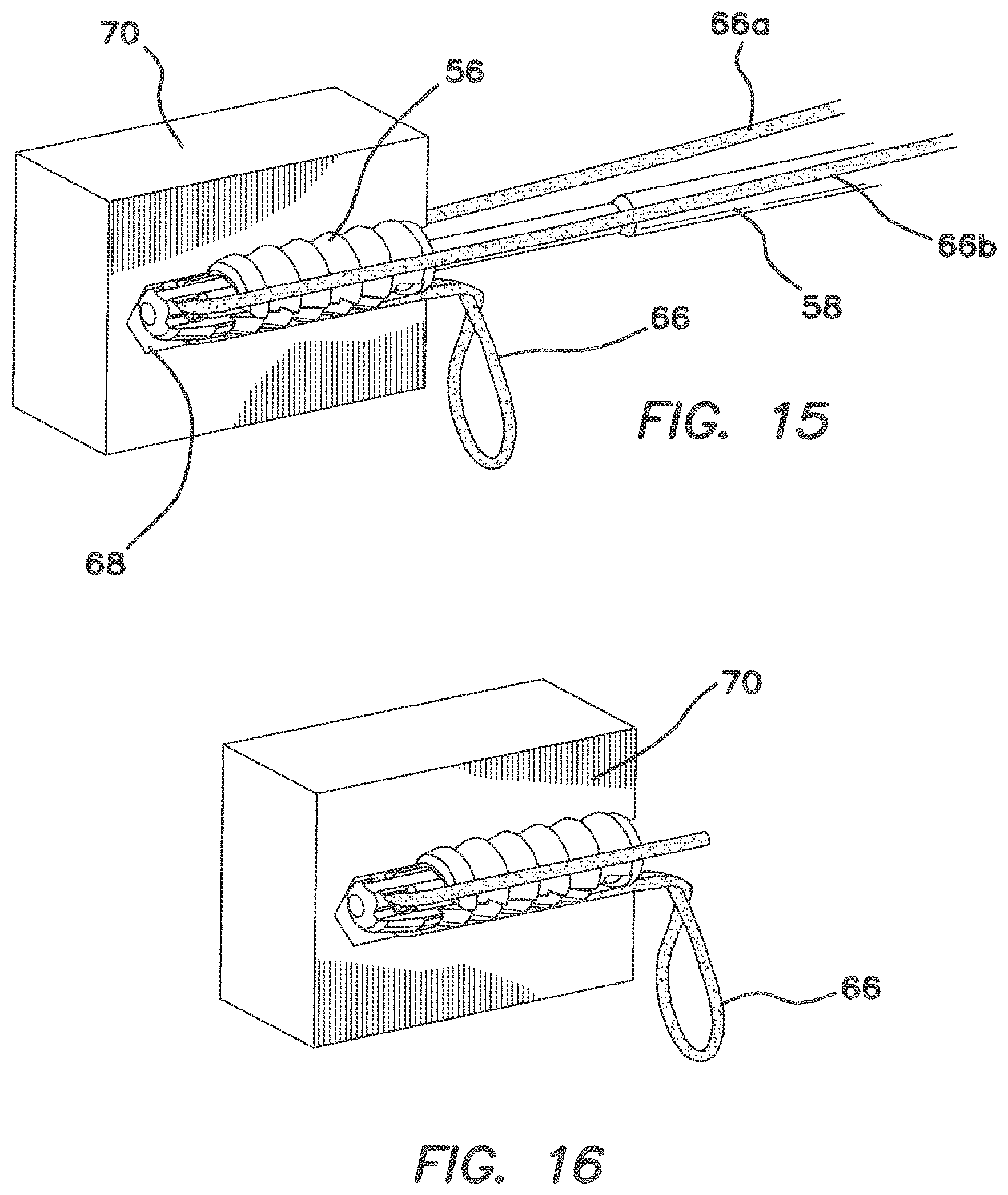 Patent US12137895 Figure 9 – Anchors and methods for securing suture to bone