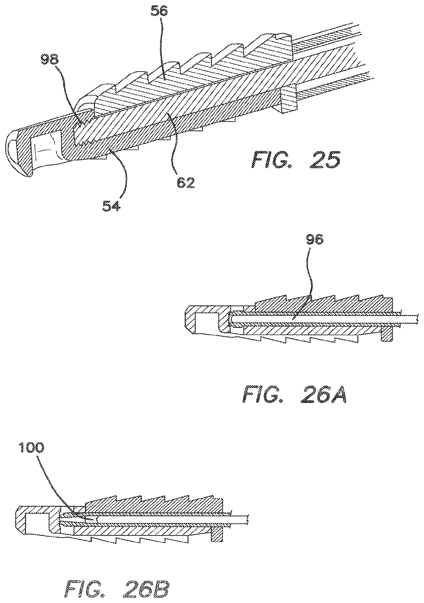 Patent US12137895 Figure 13 – Anchors and methods for securing suture to bone