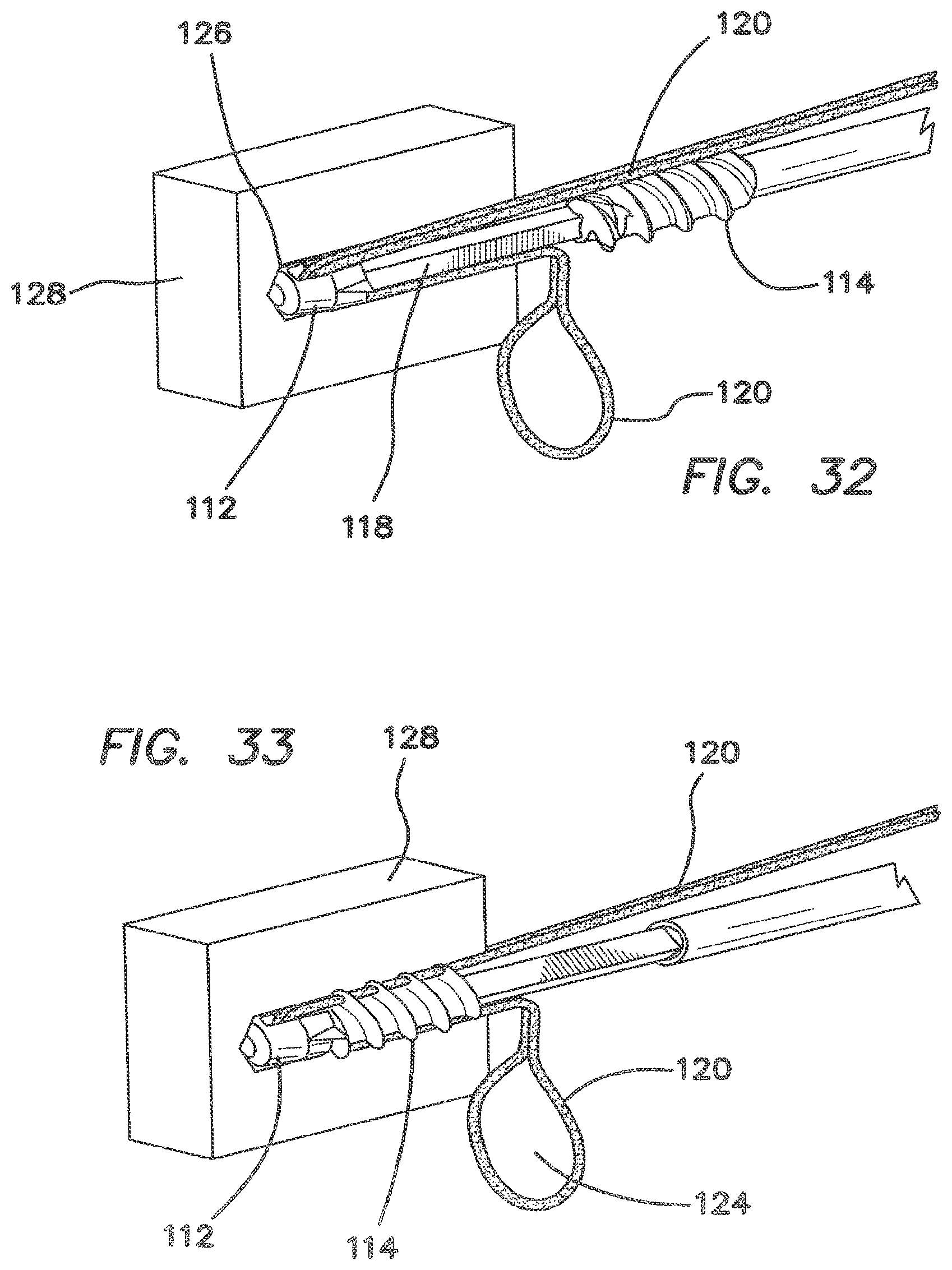 Patent US12137895 Figure 16 – Anchors and methods for securing suture to bone