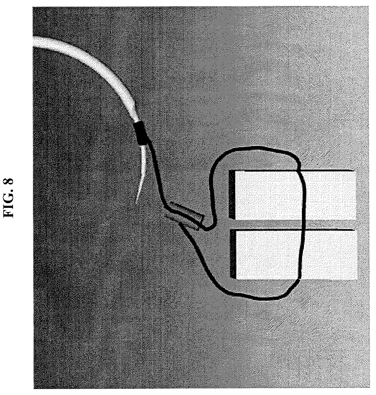 Patent US12137896 Figure 8 – Suturing apparatus with knotting tube using autotransfer and method thereof