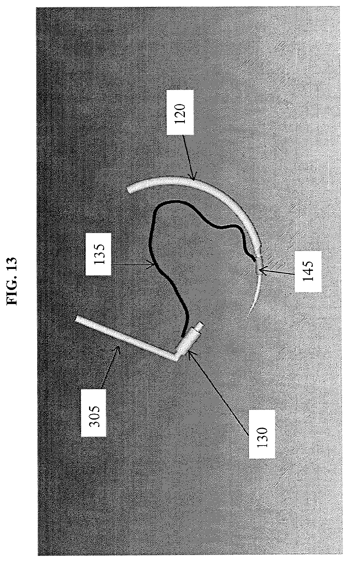 Patent US12137896 Figure 13 – Suturing apparatus with knotting tube using autotransfer and method thereof