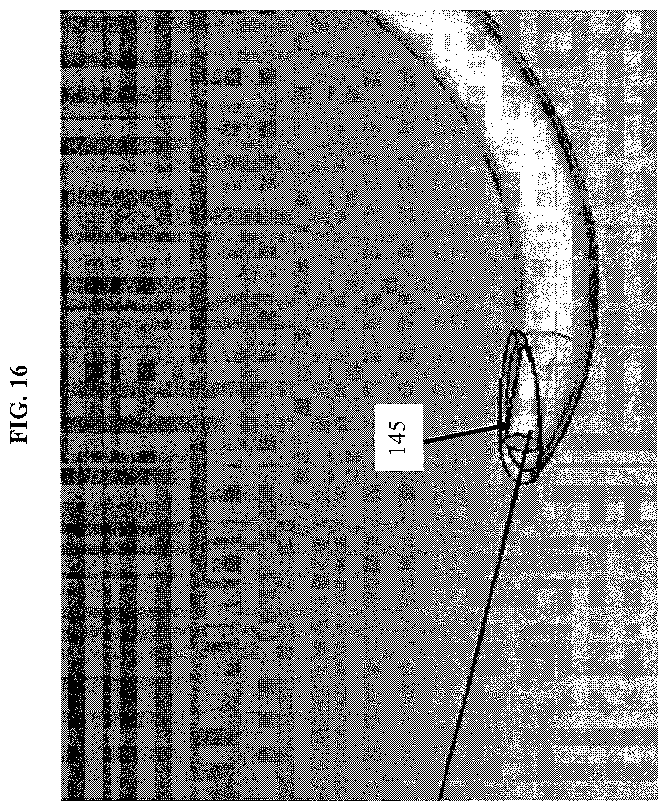 Patent US12137896 Figure 16 – Suturing apparatus with knotting tube using autotransfer and method thereof