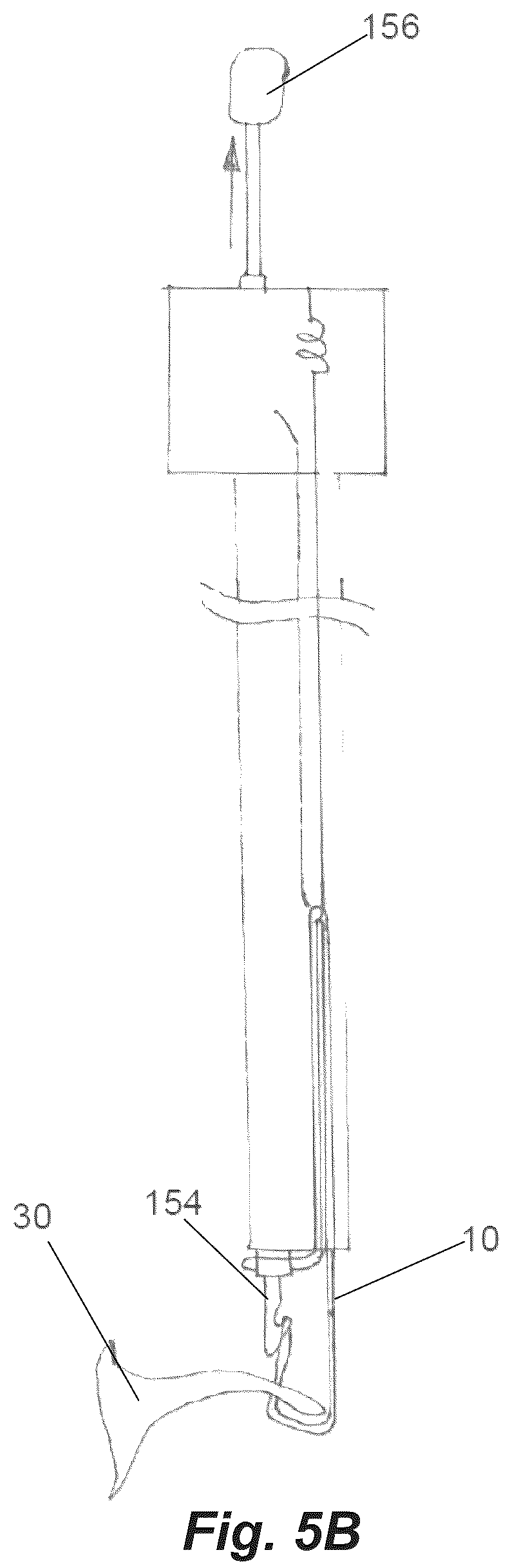 Patent US12137897 Figure 10 – Device for suture attachment for minimally invasive heart valve repair