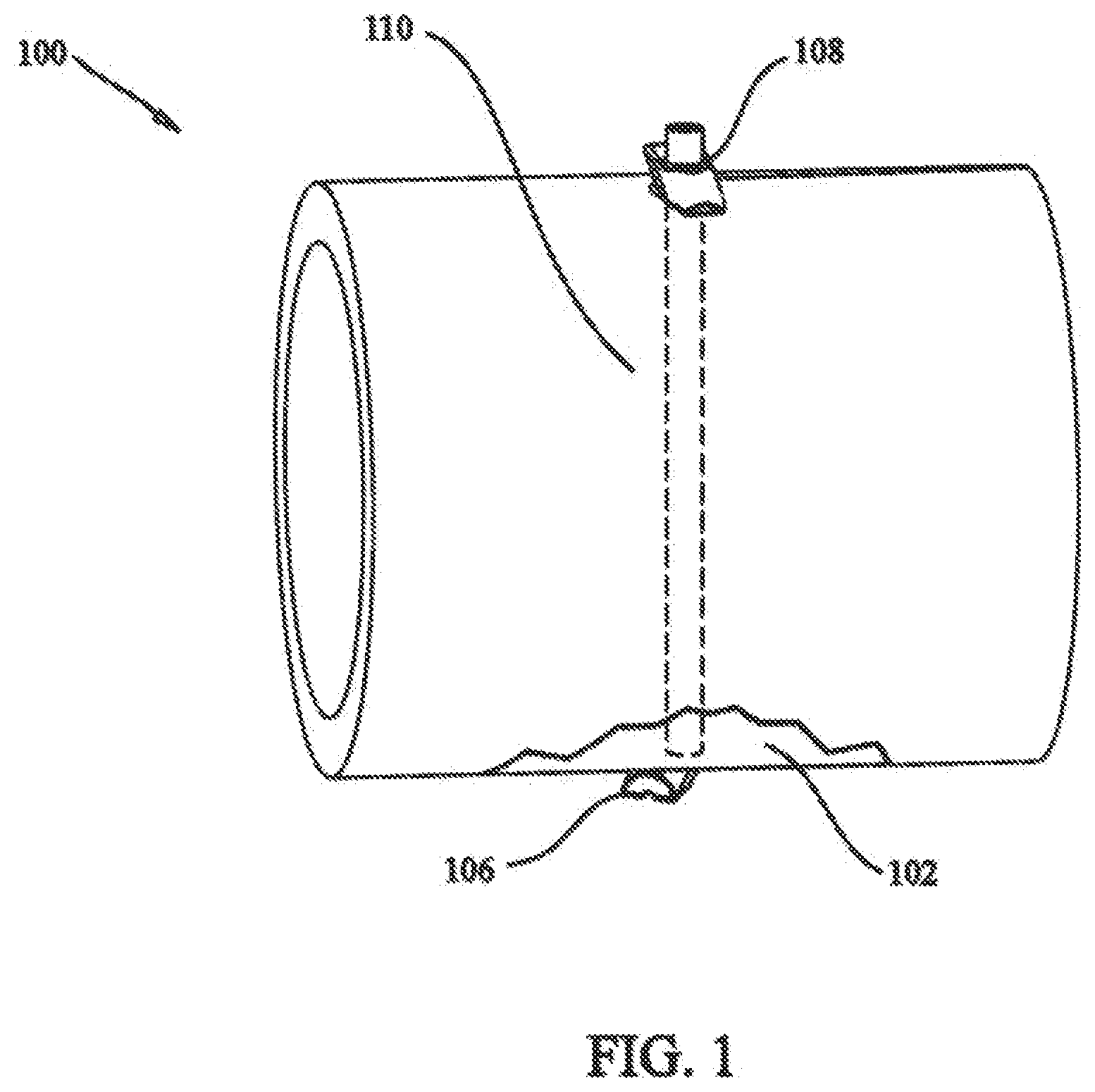 Patent US12137898 Figure 1 – Tissue fixation system and method