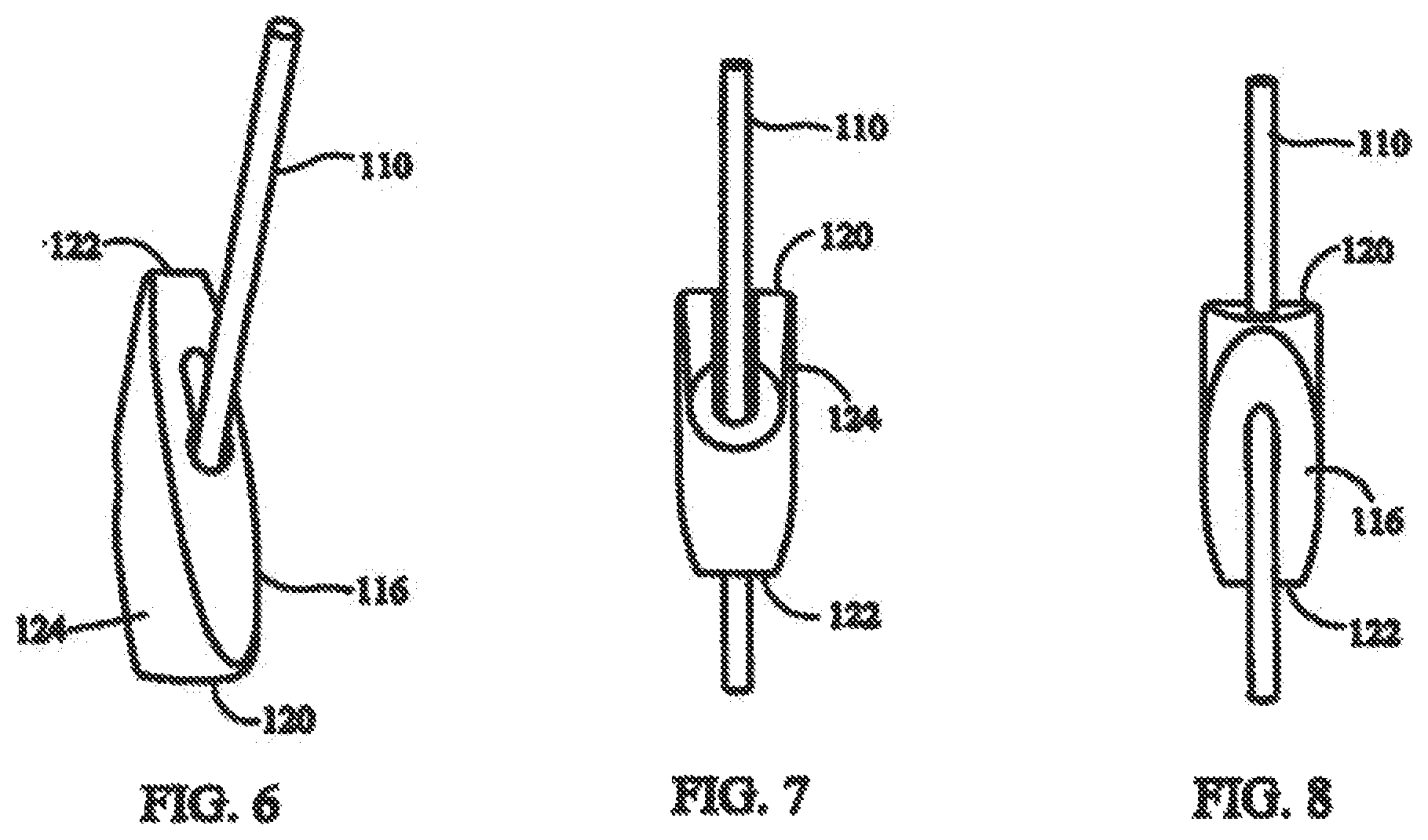 Patent US12137898 Figure 6 – Tissue fixation system and method