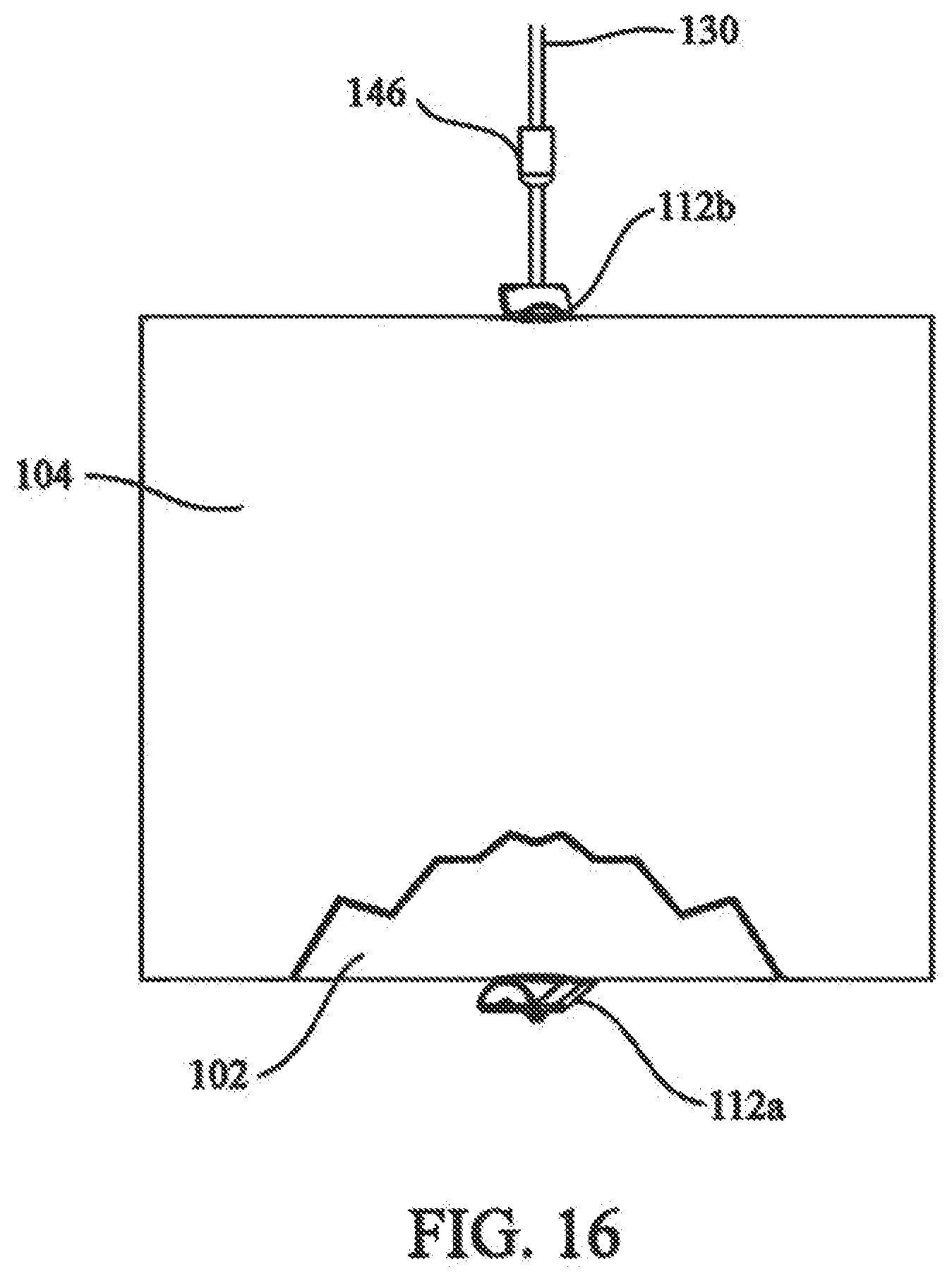 Patent US12137898 Figure 11 – Tissue fixation system and method