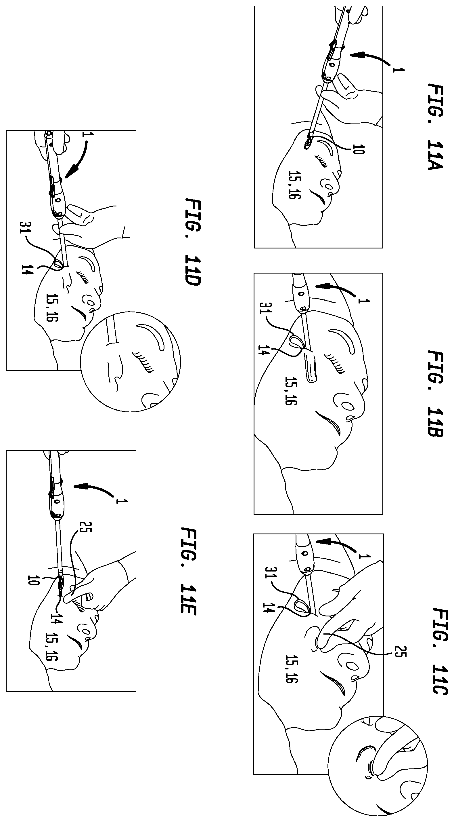 Patent US12137899 Figure 5 – Multiple suture placement system