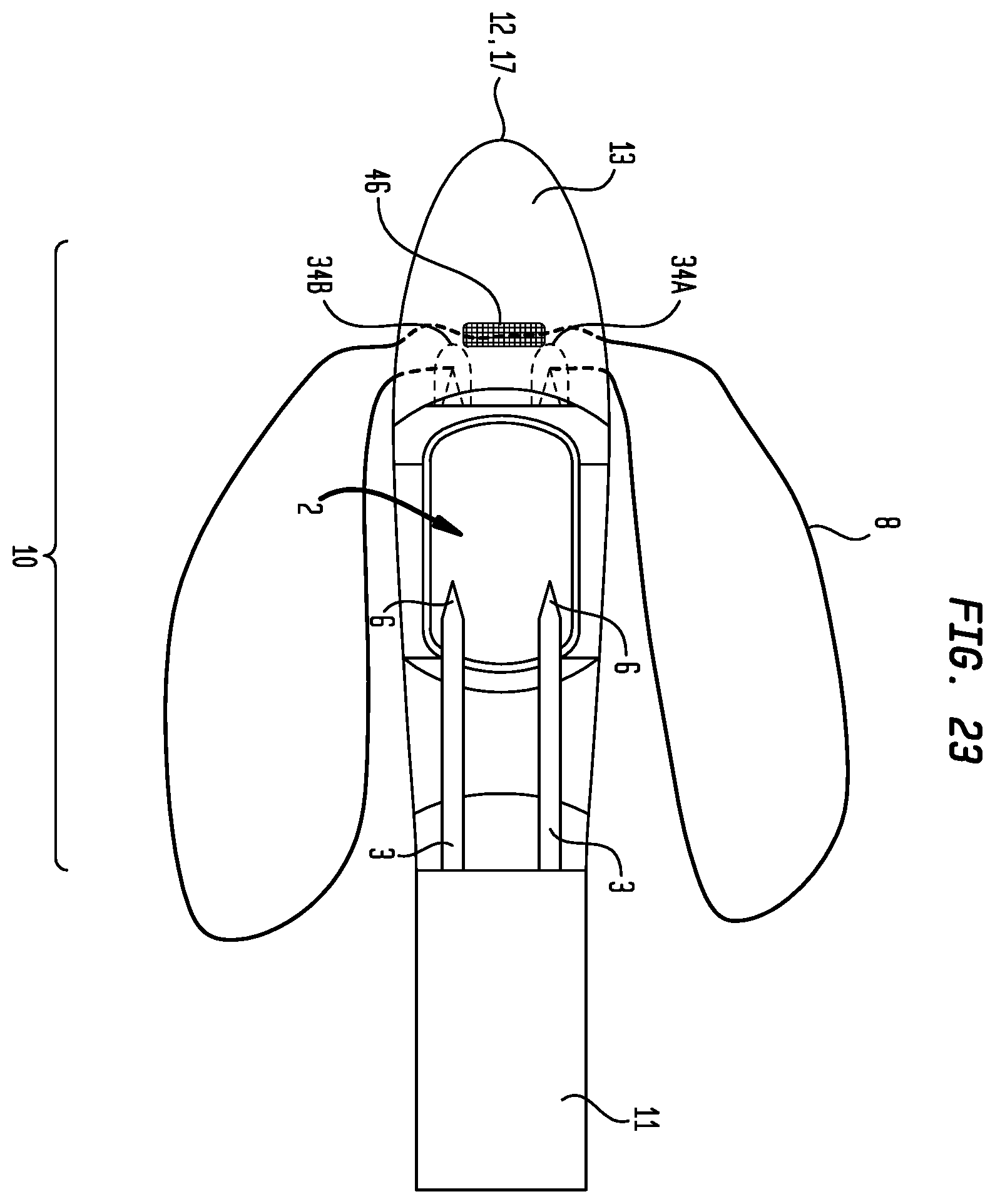 Patent US12137899 Figure 14 – Multiple suture placement system
