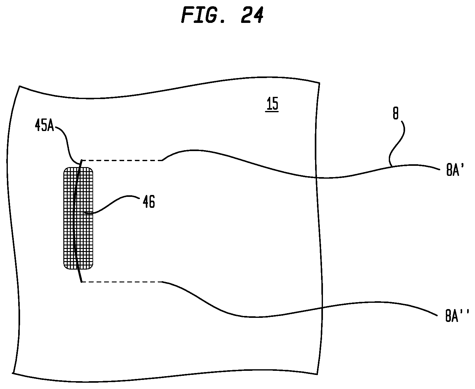 Patent US12137899 Figure 15 – Multiple suture placement system