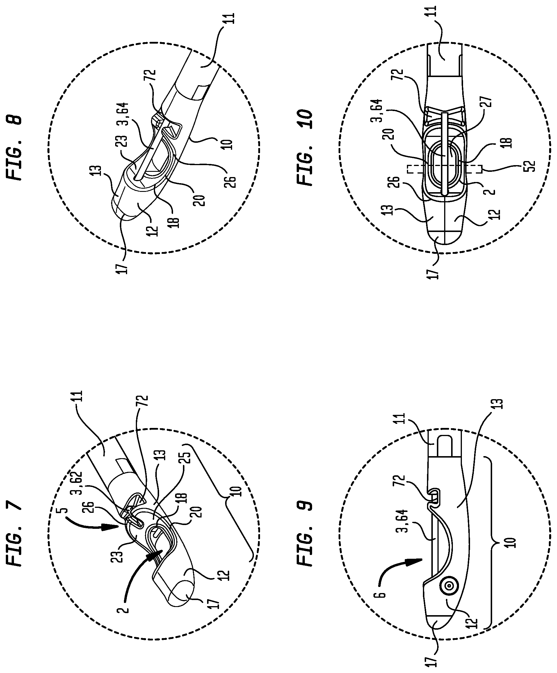 Patent US12137900 Figure 4 – Suture system