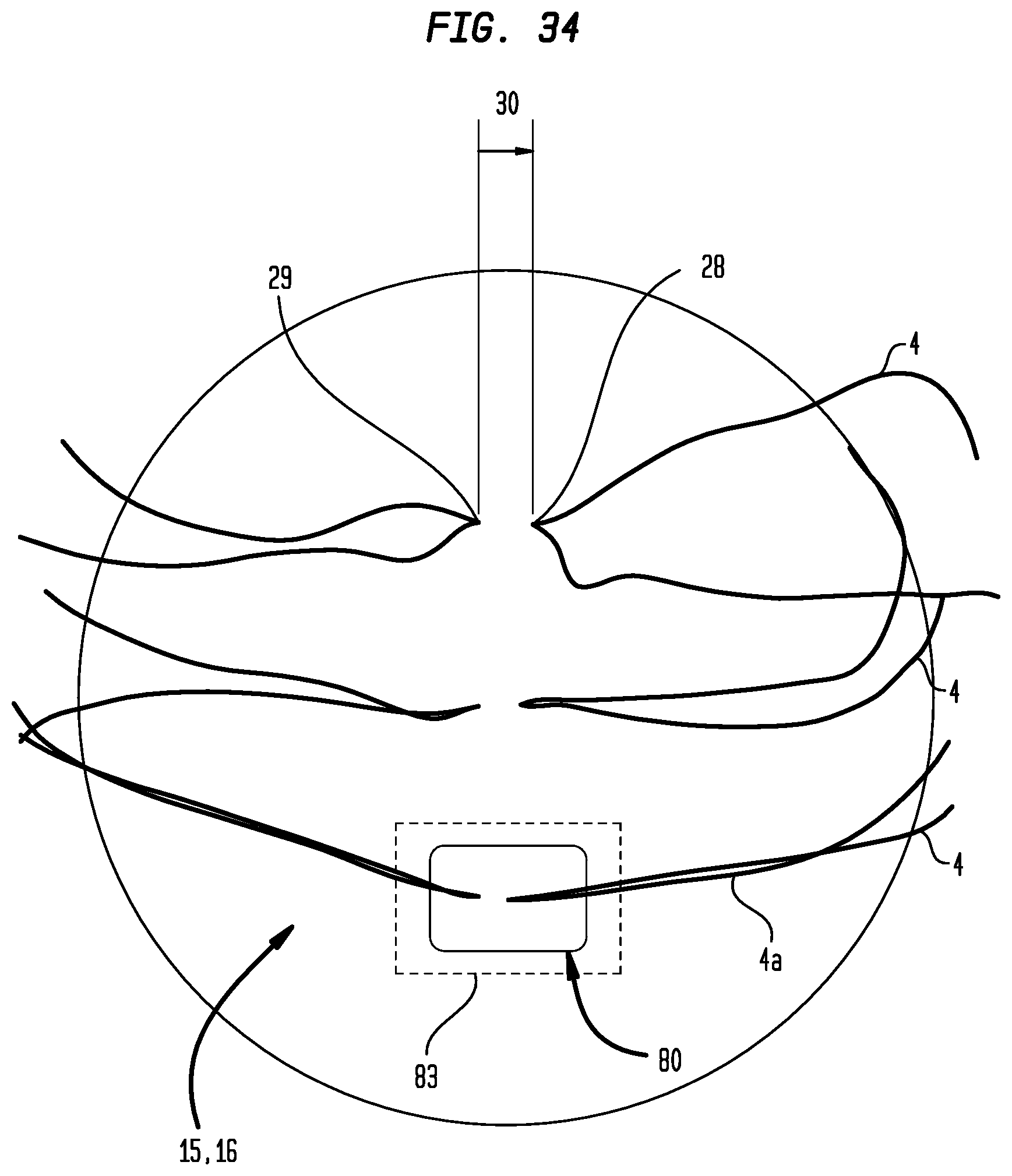 Patent US12137900 Figure 16 – Suture system