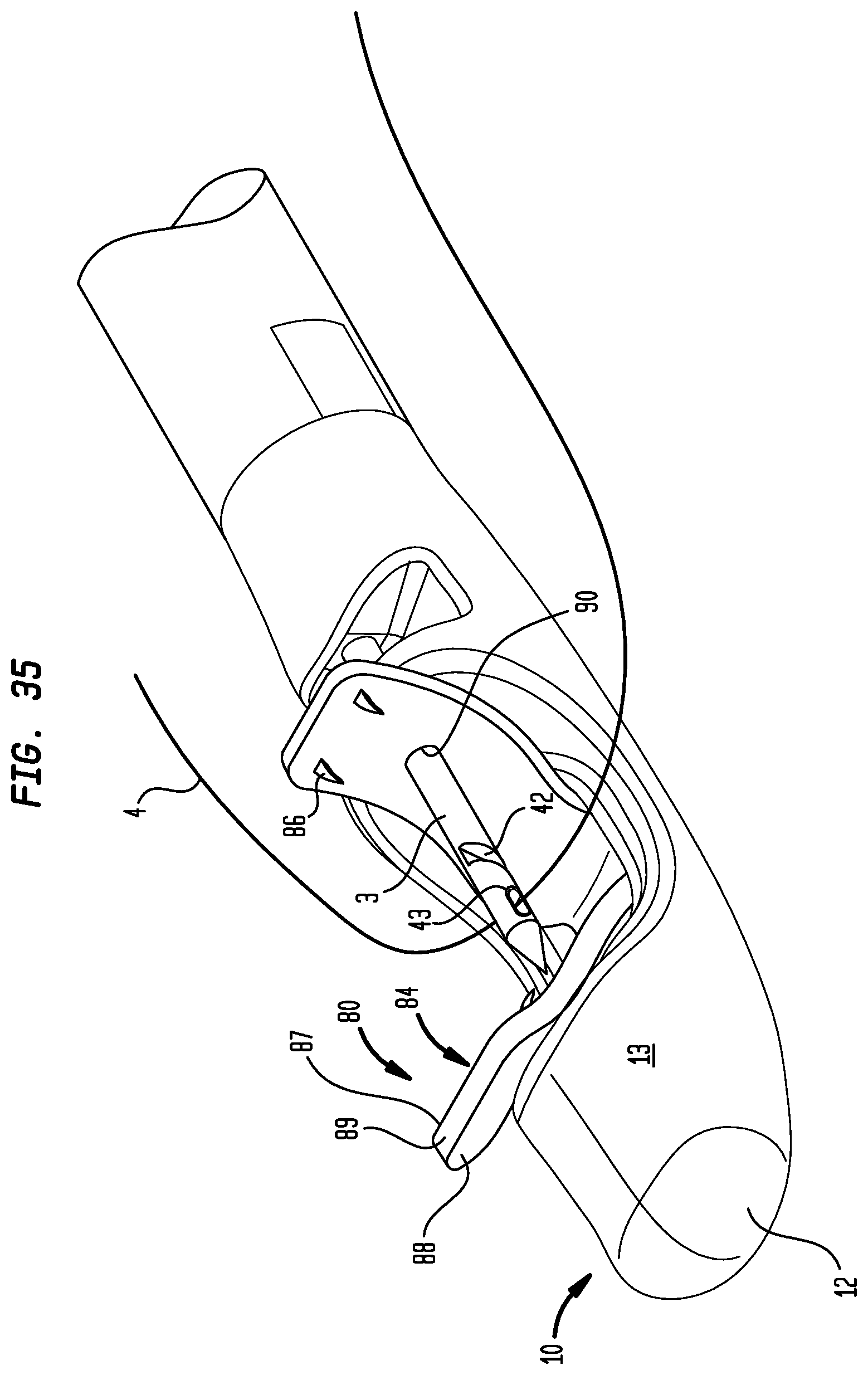 Patent US12137900 Figure 17 – Suture system