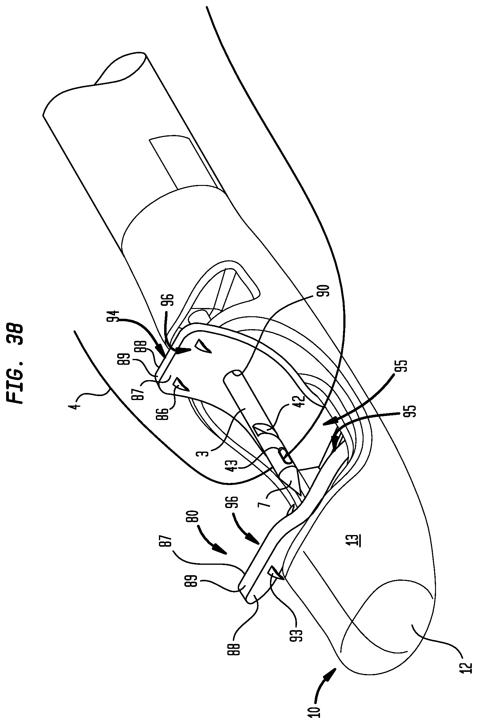 Patent US12137900 Figure 19 – Suture system