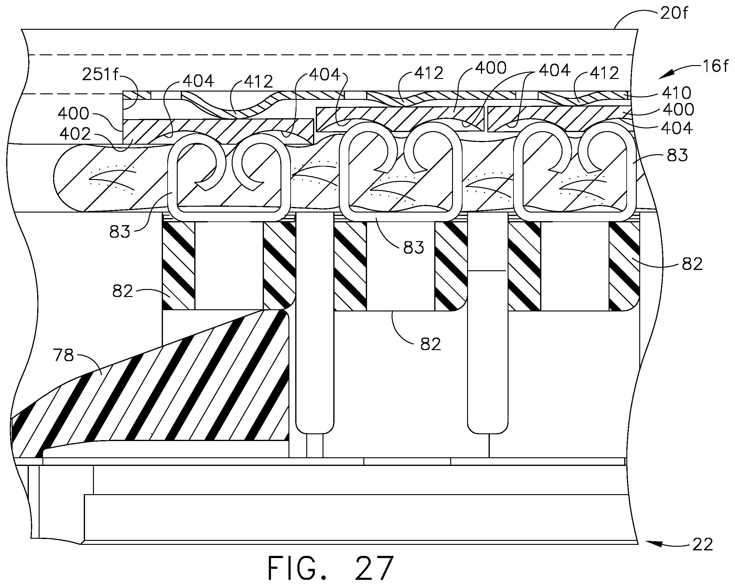 Patent US12137901 Figure 20 – Surgical staples having compressible or crushable members for securing tissue therein and stapling instruments for deploying the same