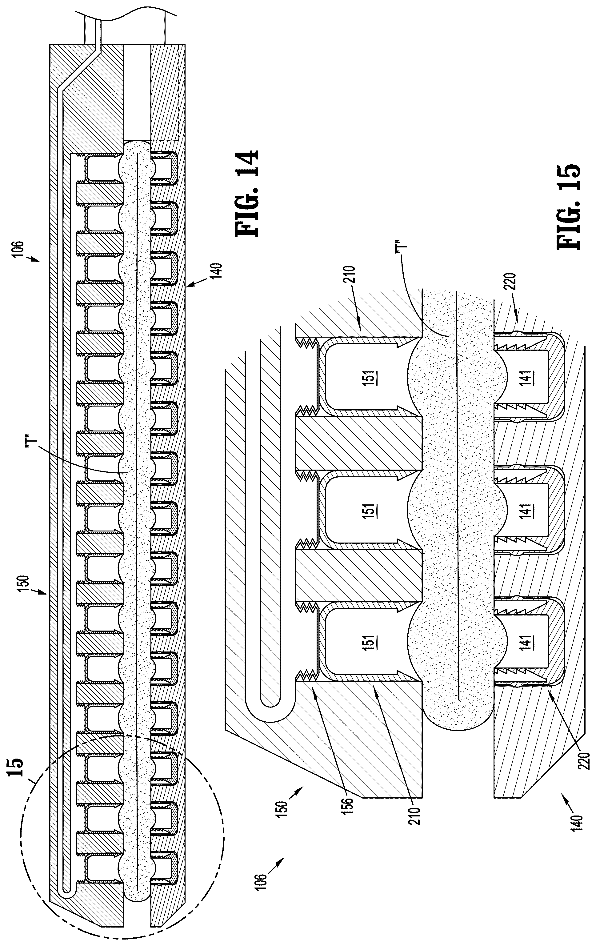 Patent US12137905 Figure 8 – Gas-powered continuous feed surgical fastening device
