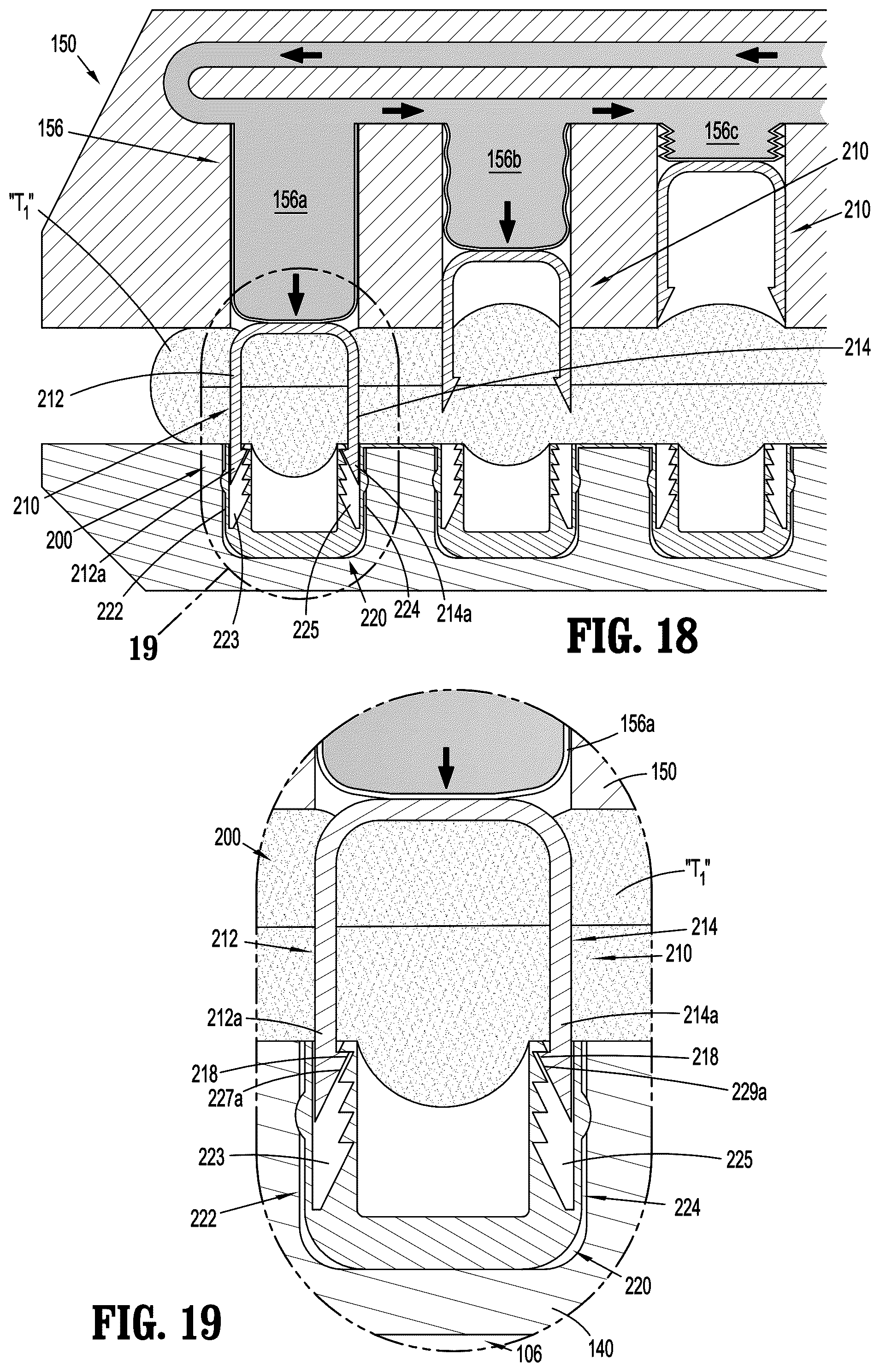 Patent US12137905 Figure 10 – Gas-powered continuous feed surgical fastening device